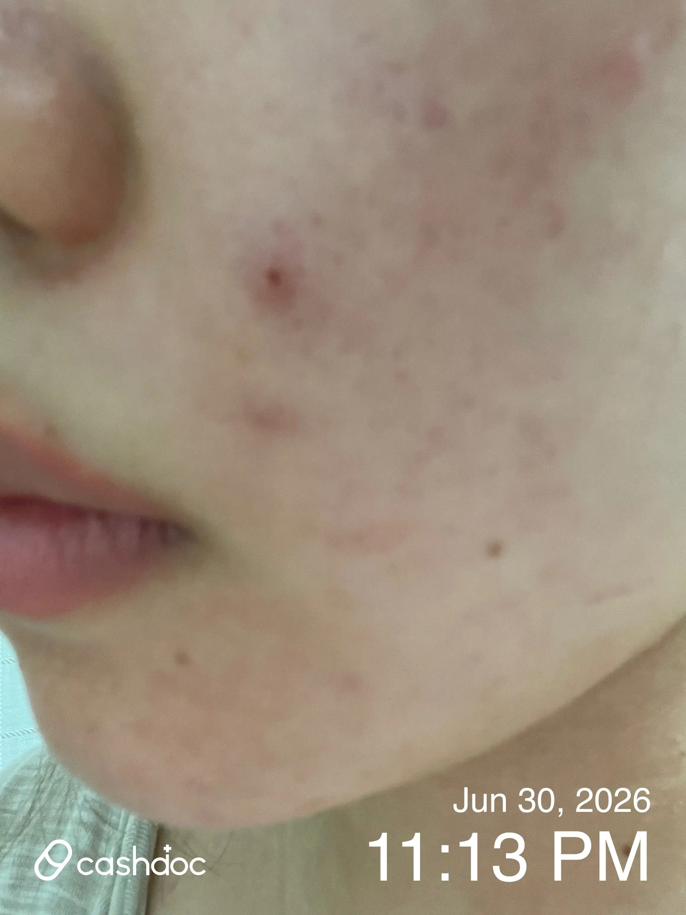 Review photo
