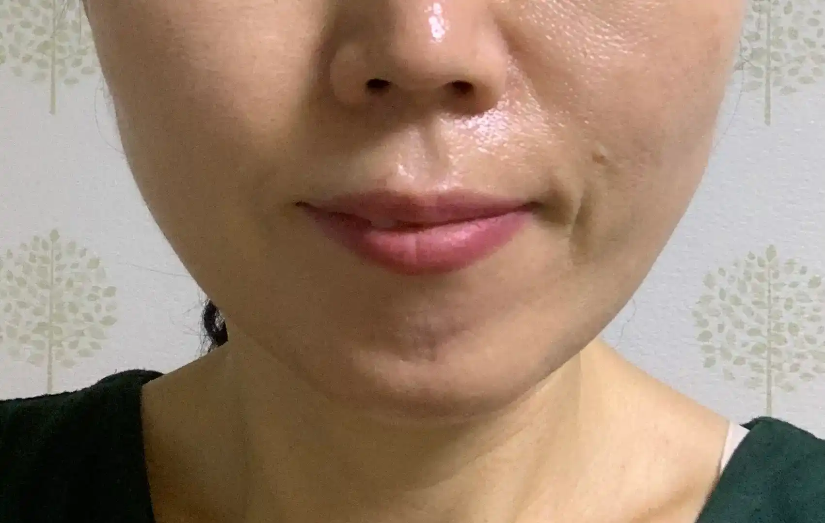 후