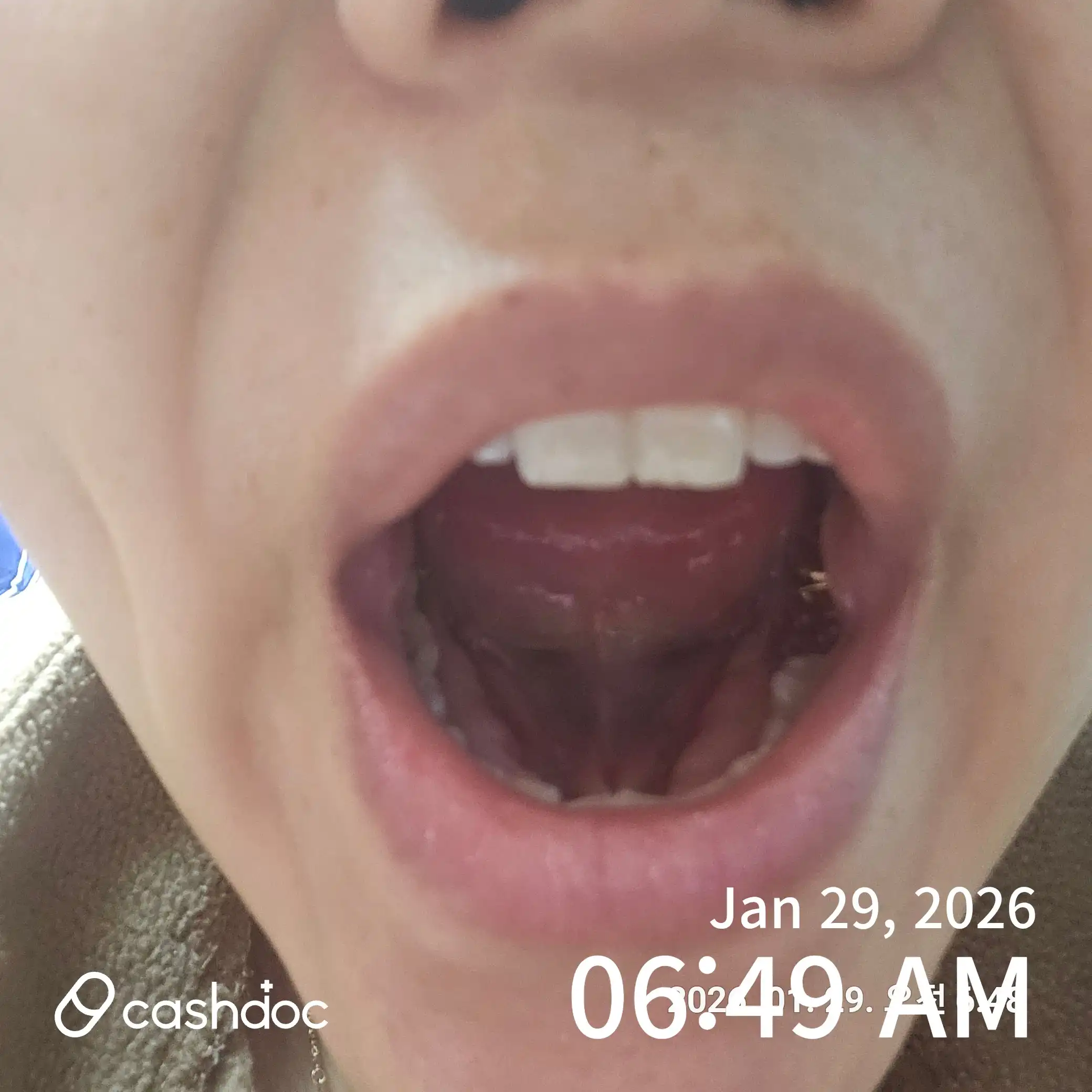 Review photo