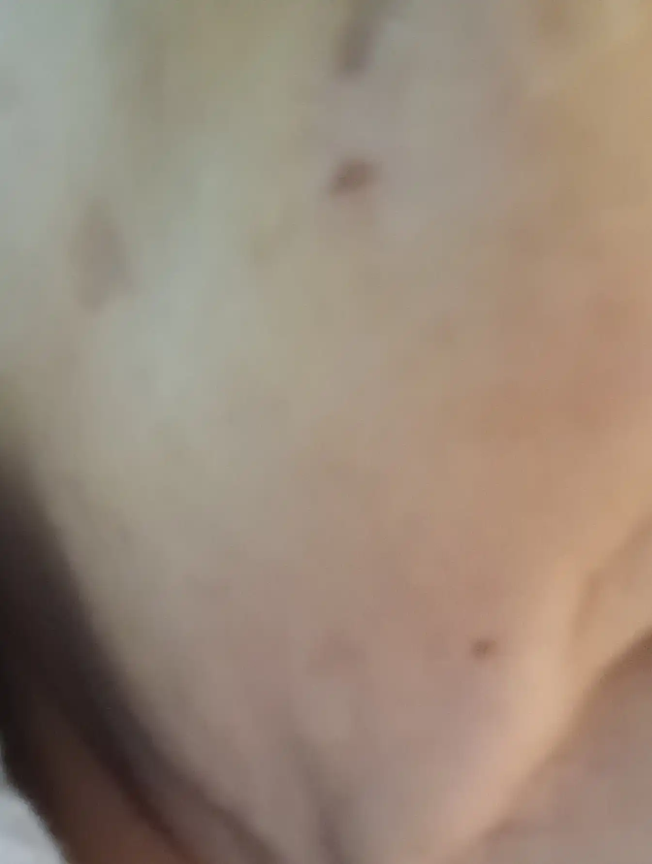 후