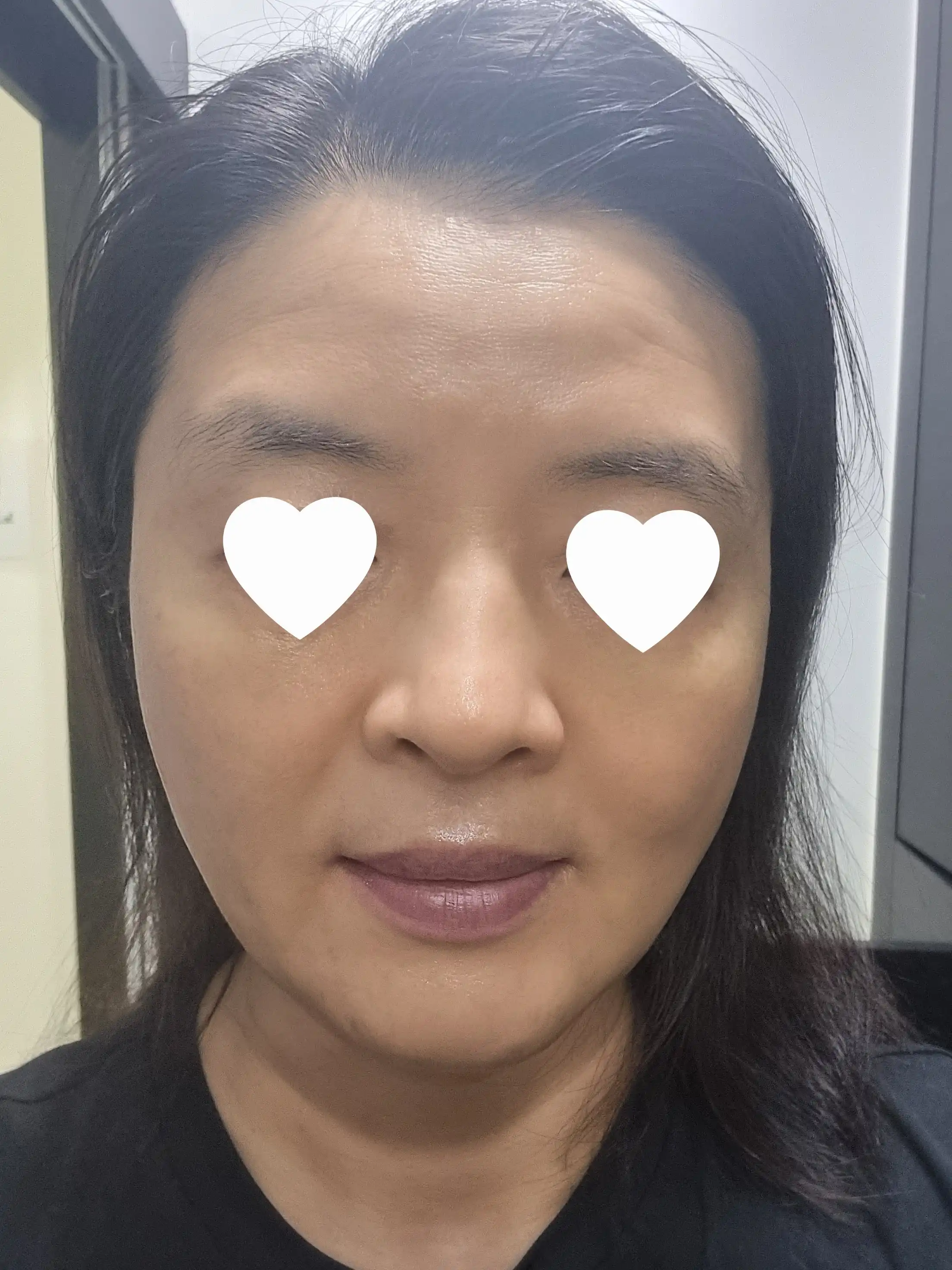 후