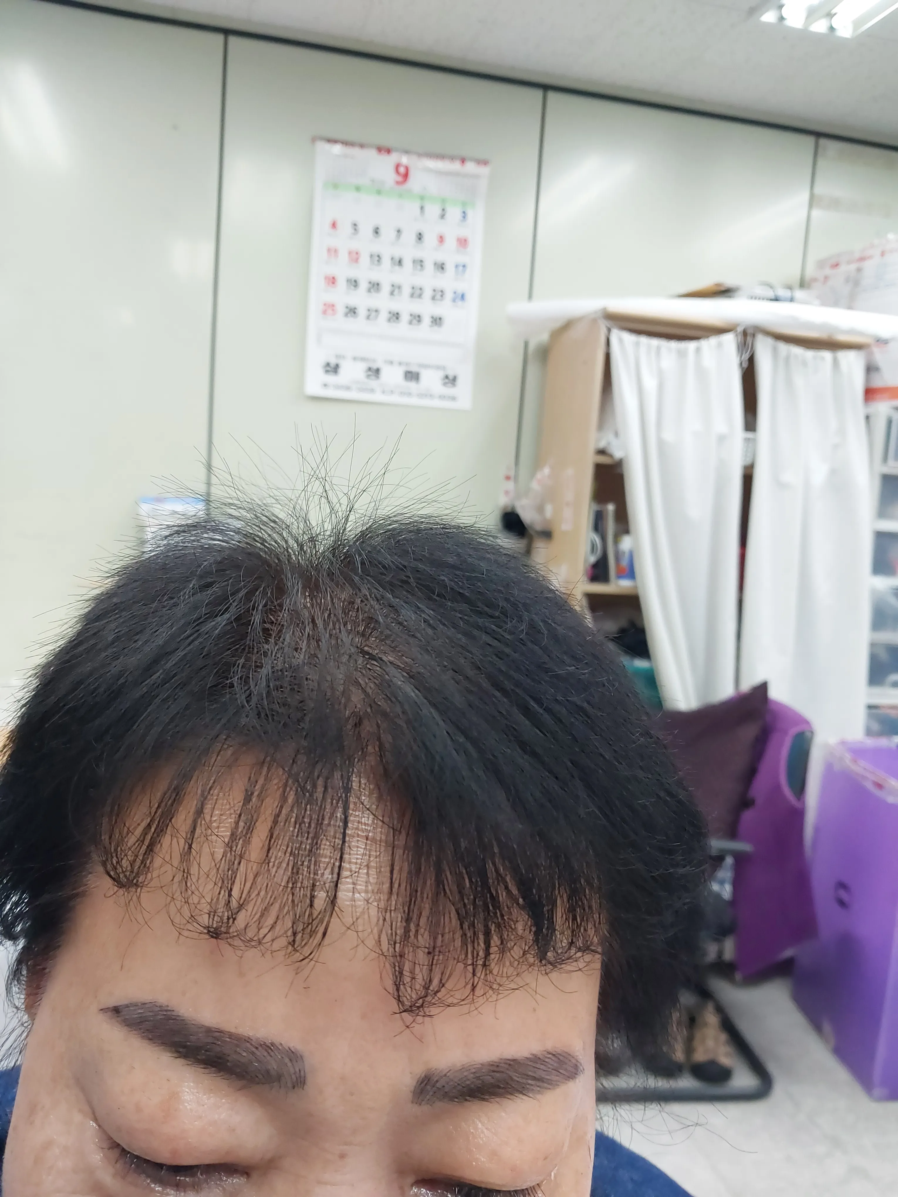 시술 후 — 	번지지않는 아이라인반영구	