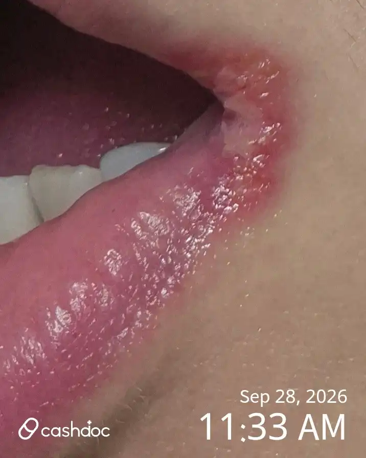 评价照片