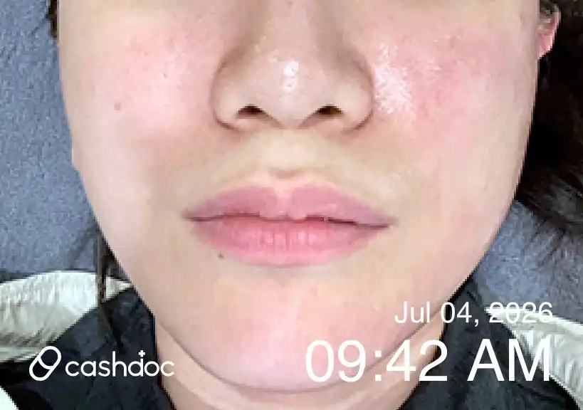 Review photo