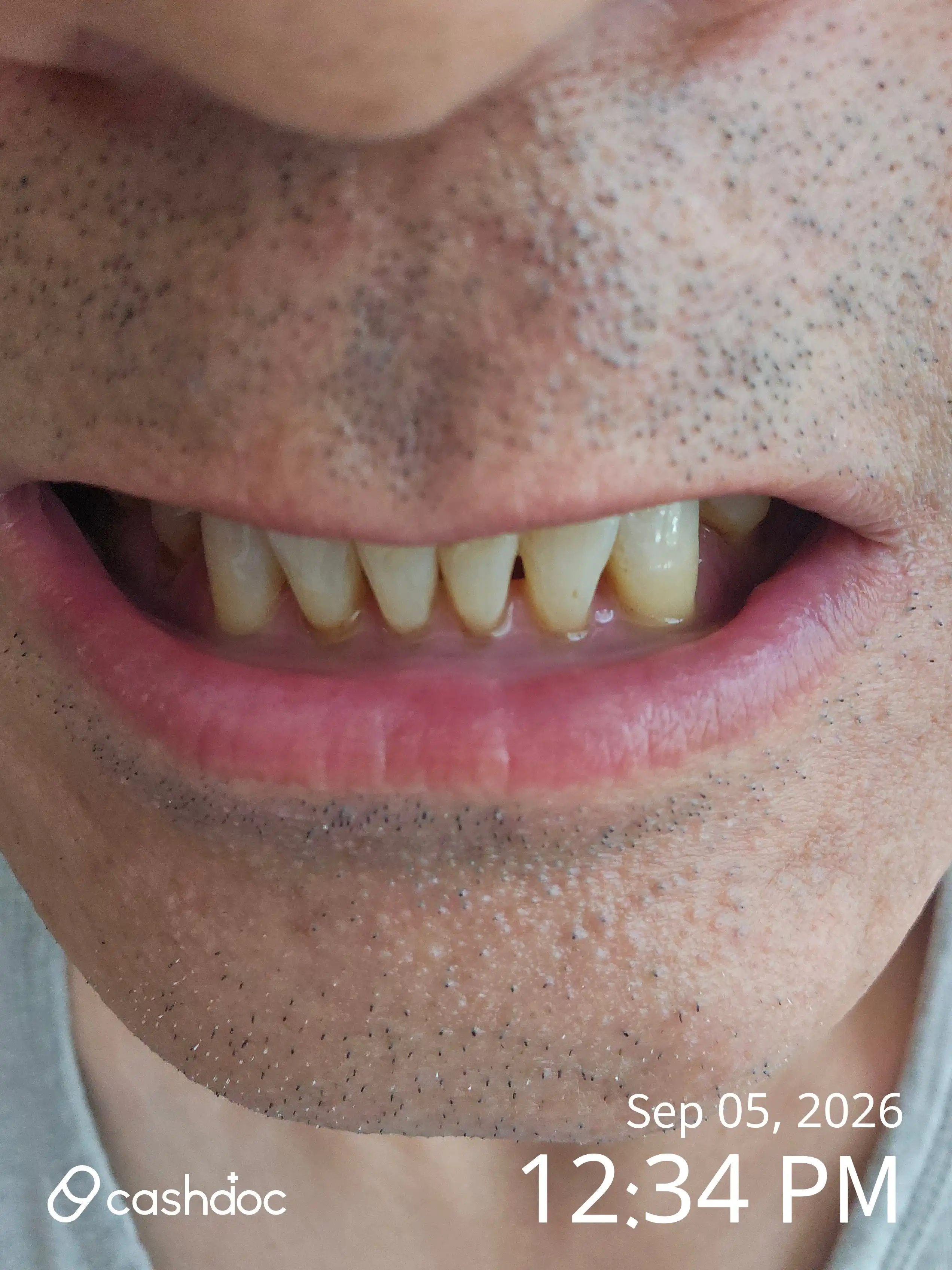 Review photo