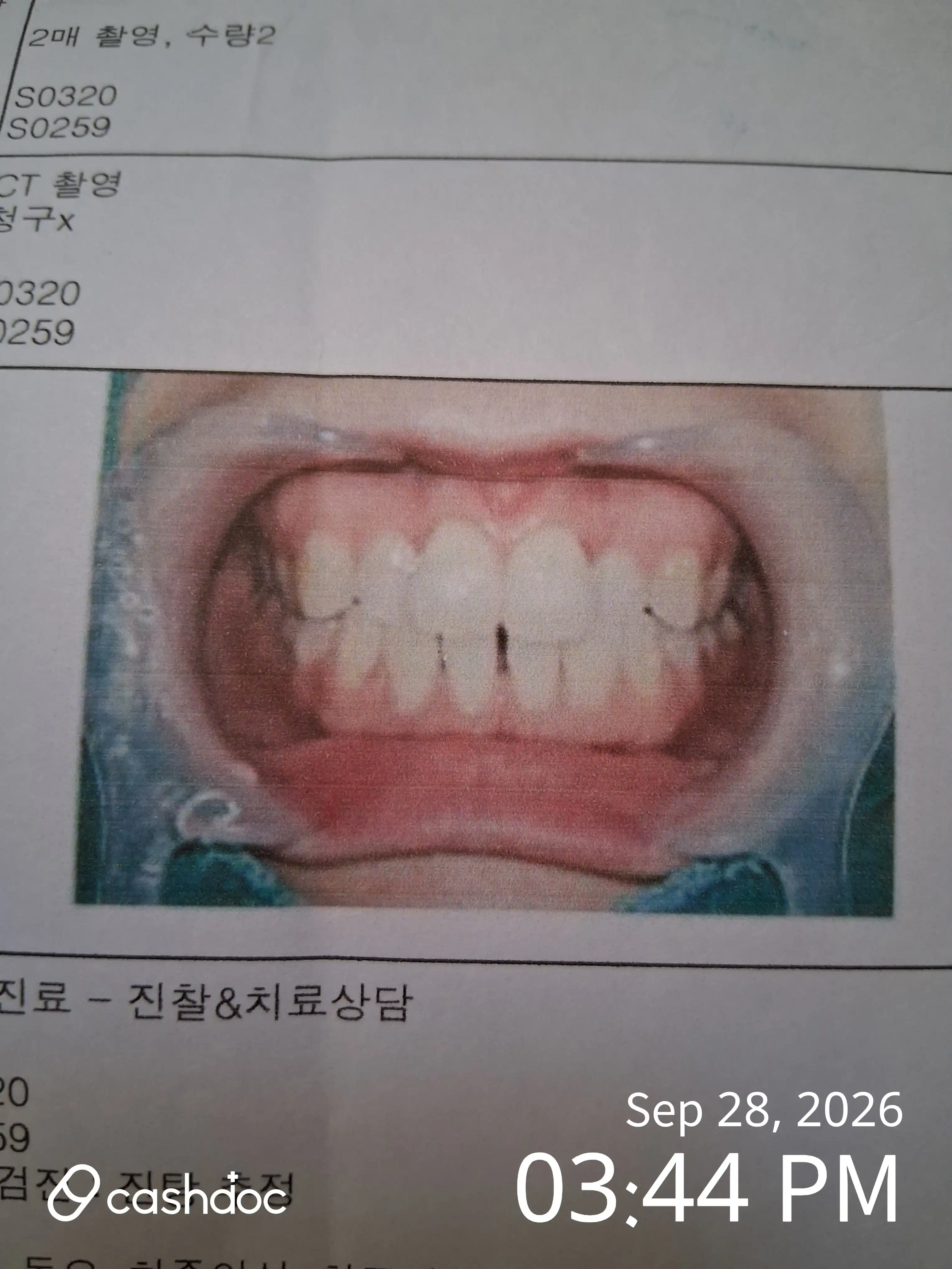리뷰 사진