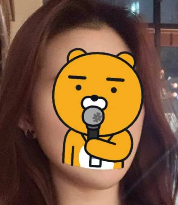 After treatment — Wonjin_Facial Contouring