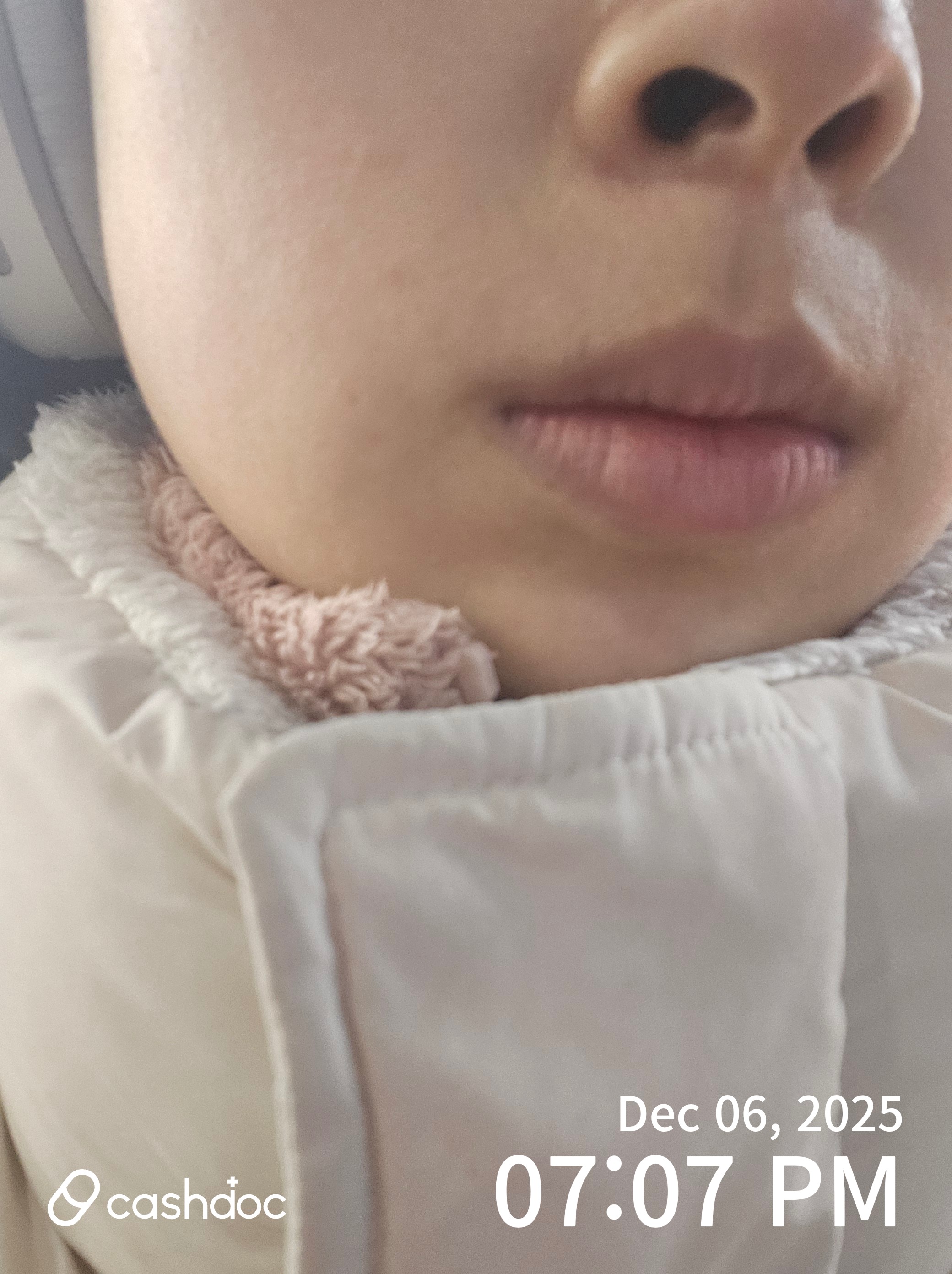 경기도 인계동에서 찾은 김지훈피부과의원, 친절하고 과잉진료 없는 진료 경험