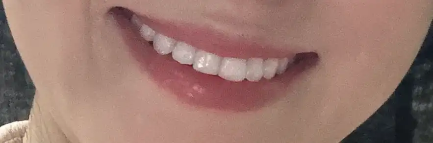 후