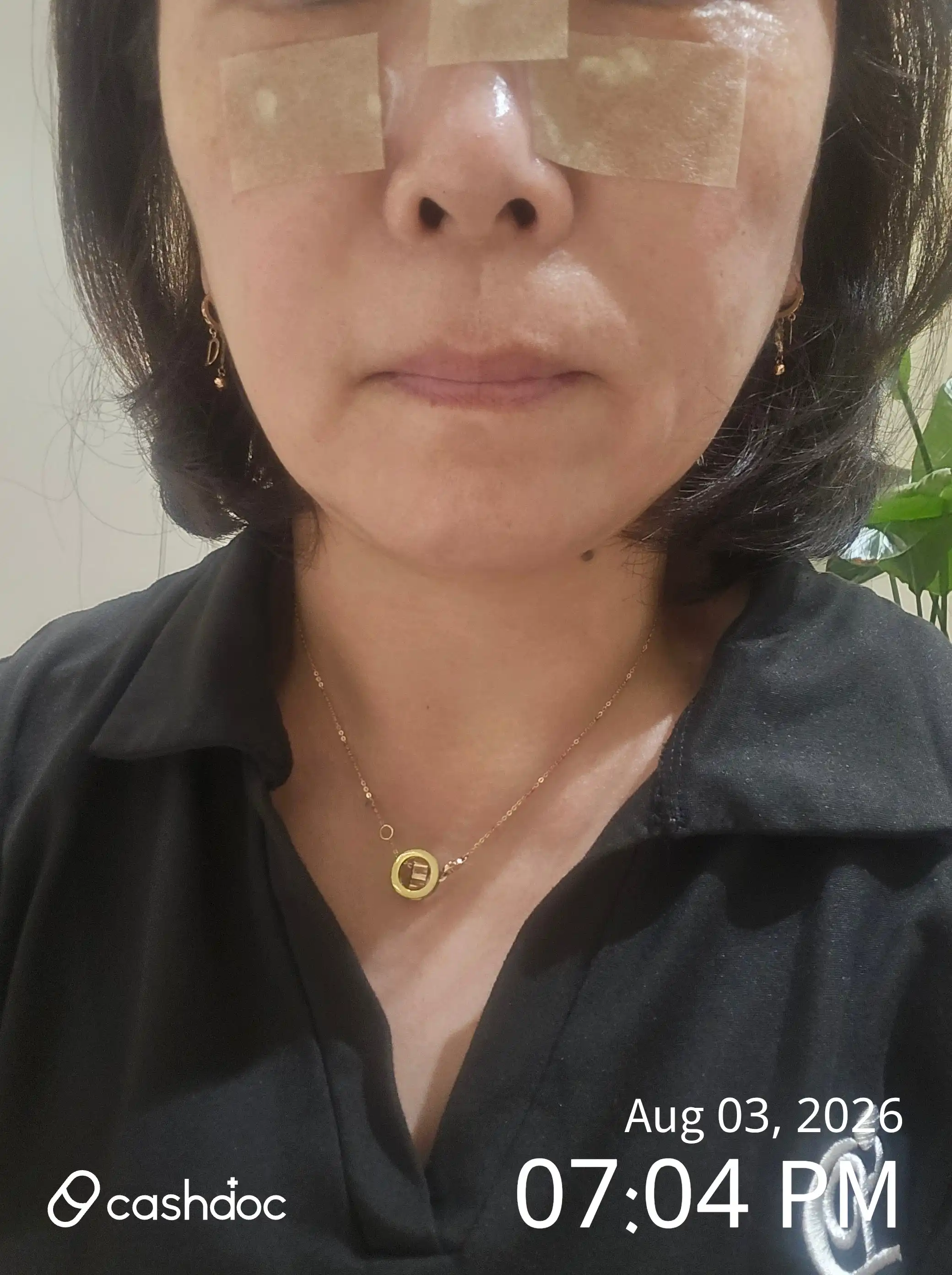 评价照片