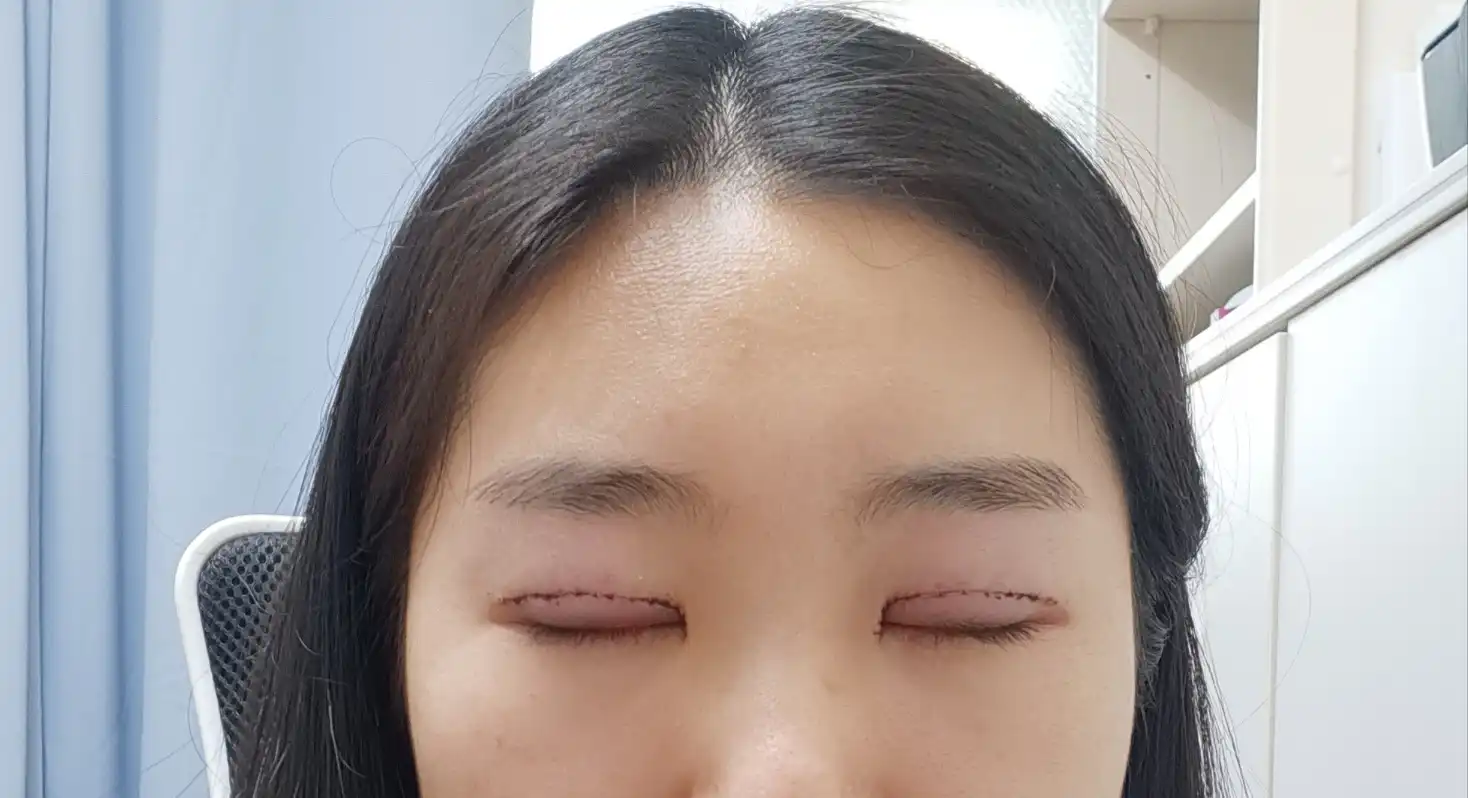 후