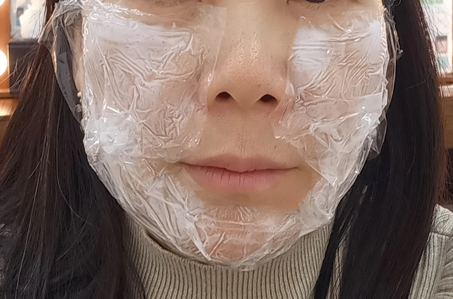 시술 전 — 미케이 피부 탄력개선_슈링크 300샷