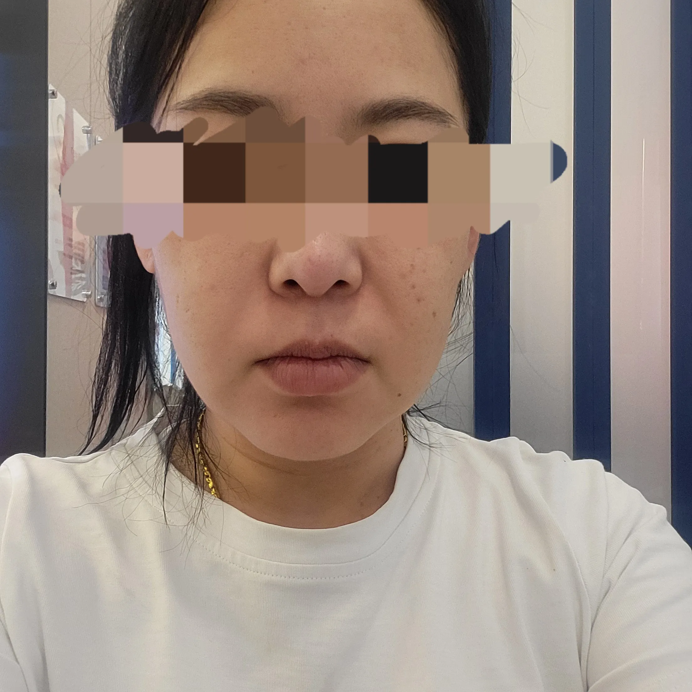 评价照片