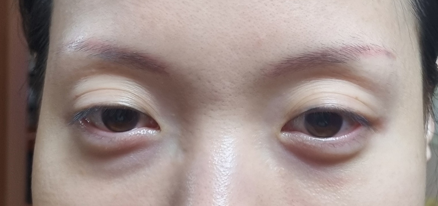 评价照片
