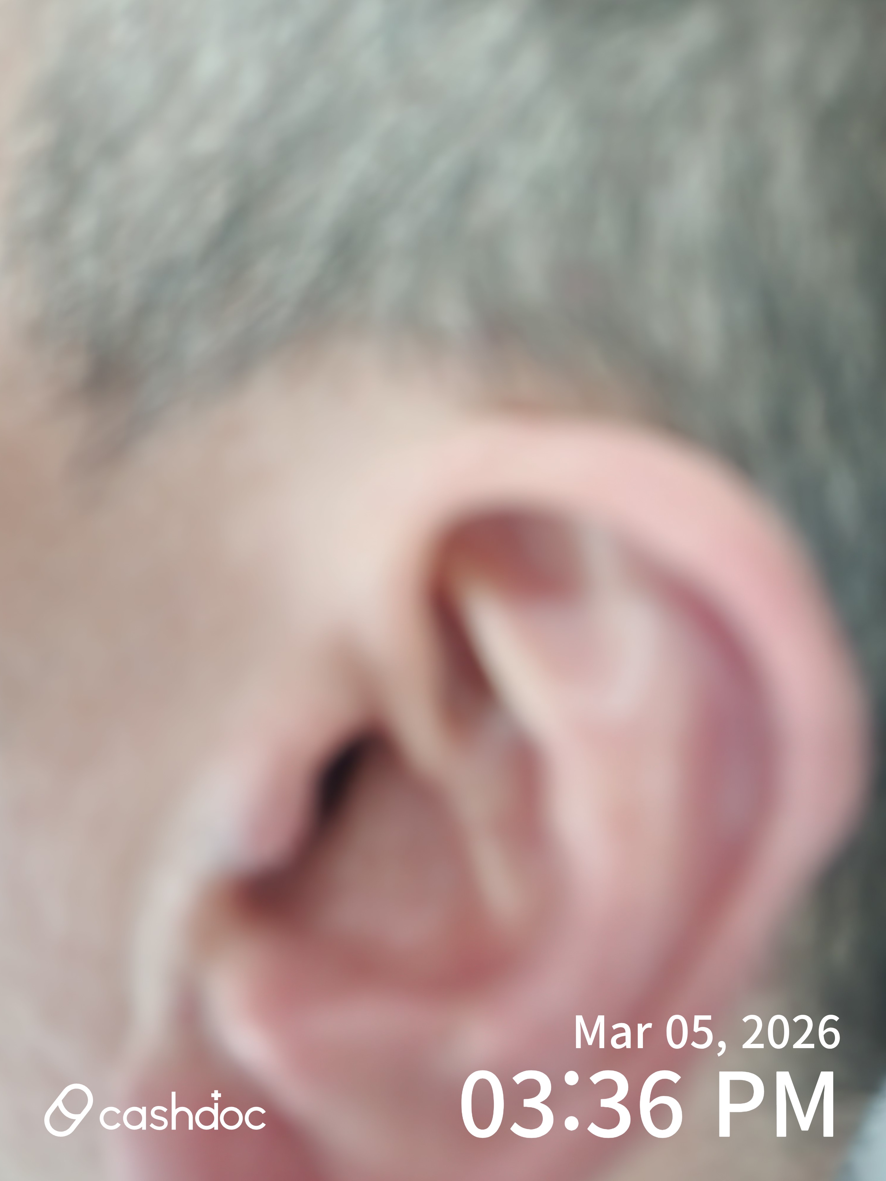 평택시 바른소리이비인후과의원, 친절한 귀 건강 관리 안내