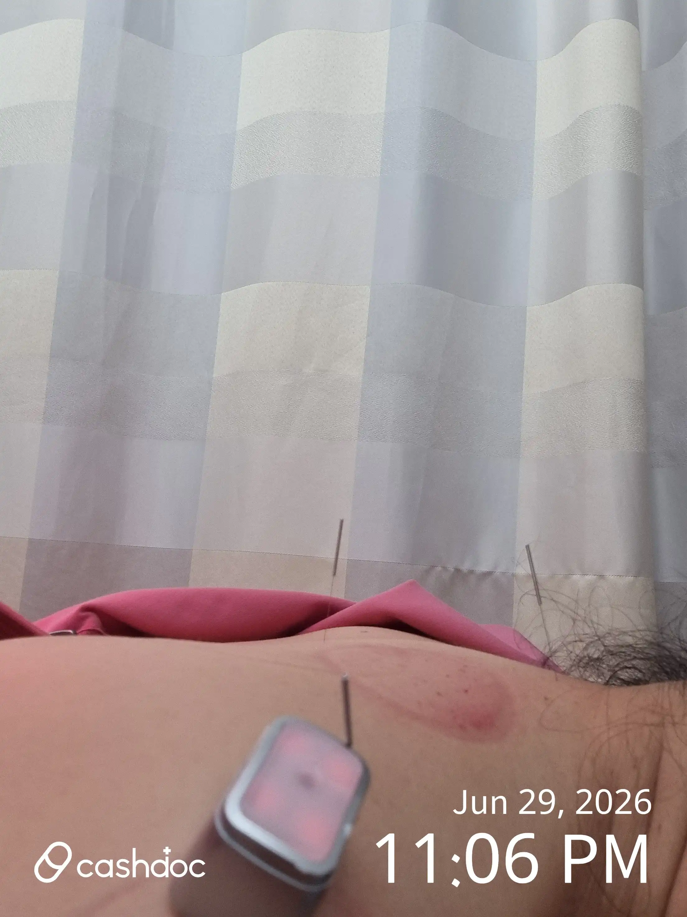 Review photo