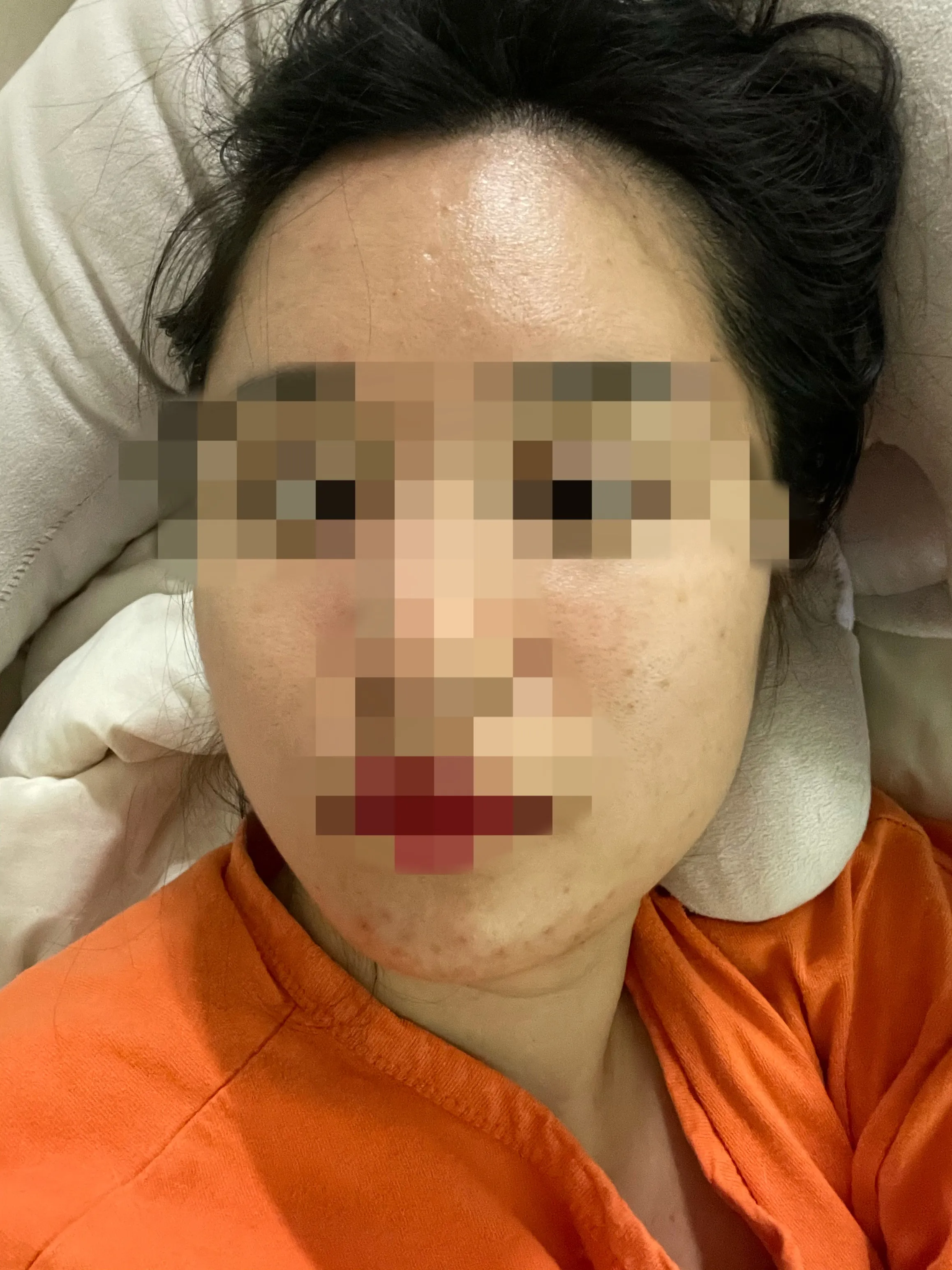 Before treatment — Sleep Rejuran 29.9