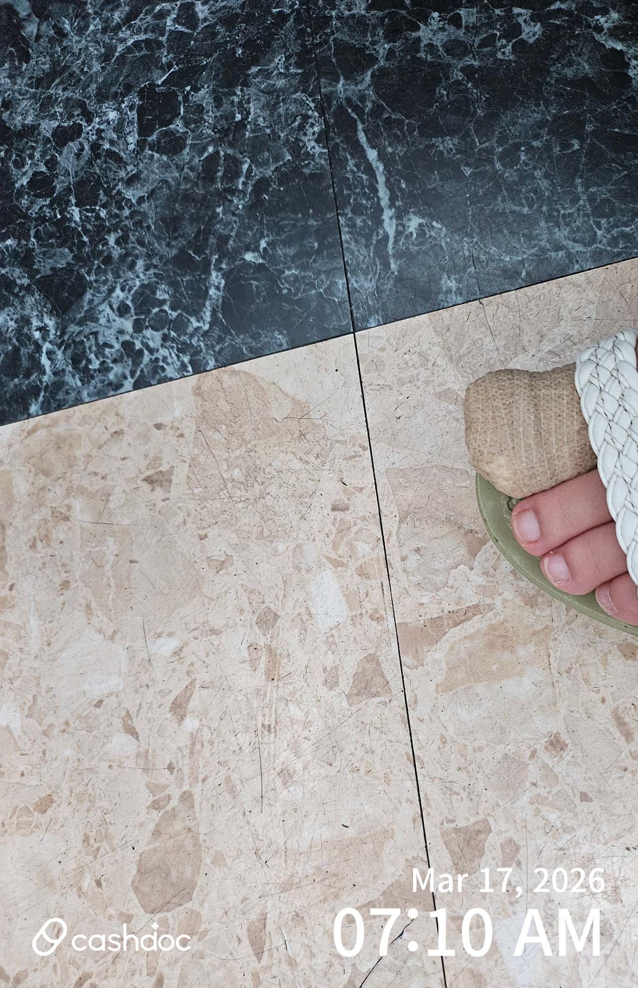 서구 삼성플러스유외과, 내성발톱 수술없이 치료 성공!