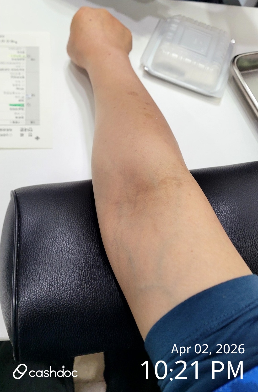 고양시 바른신경외과의원, 손가락 염증에 효과적인 치료!