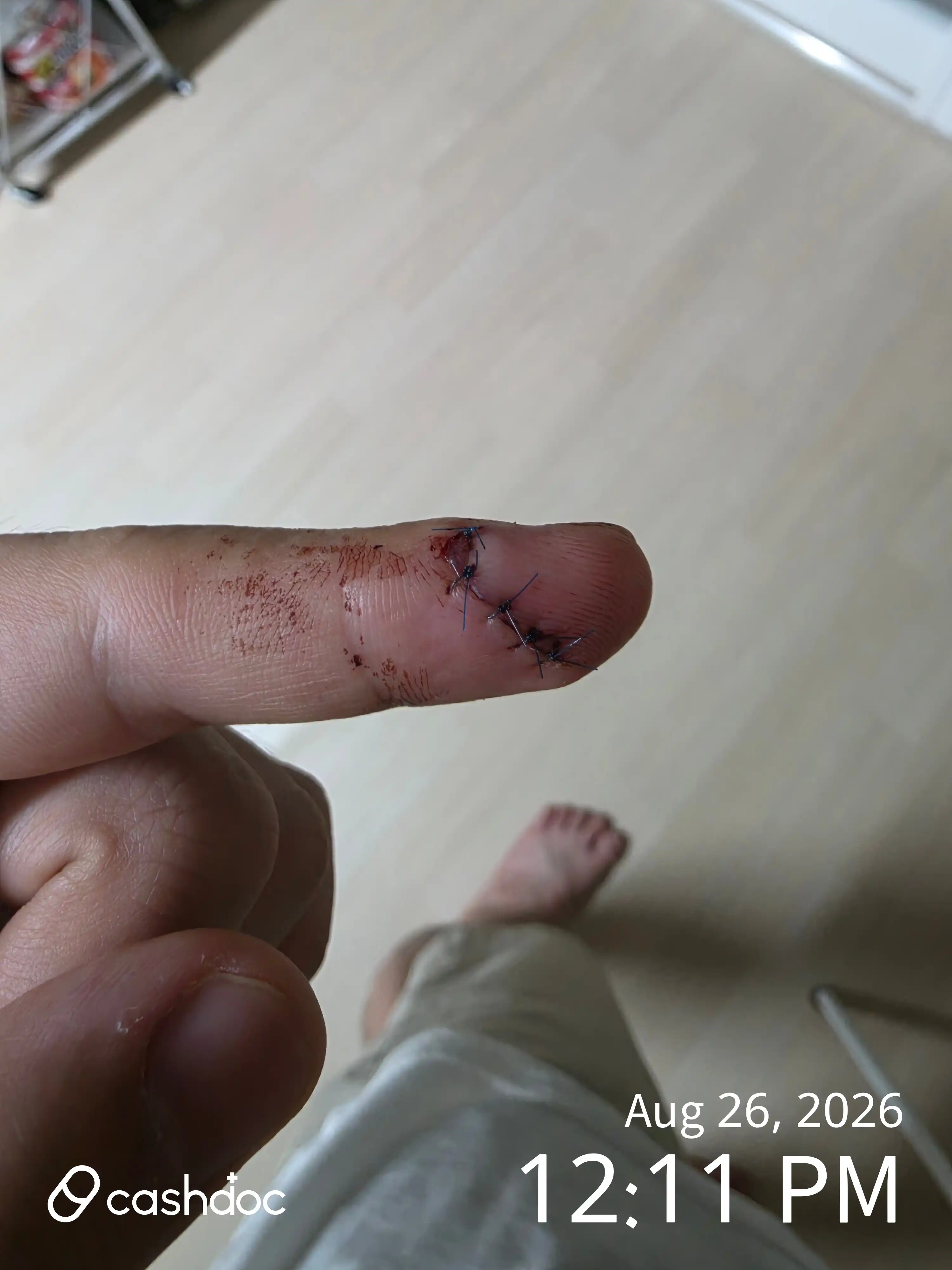 评价照片