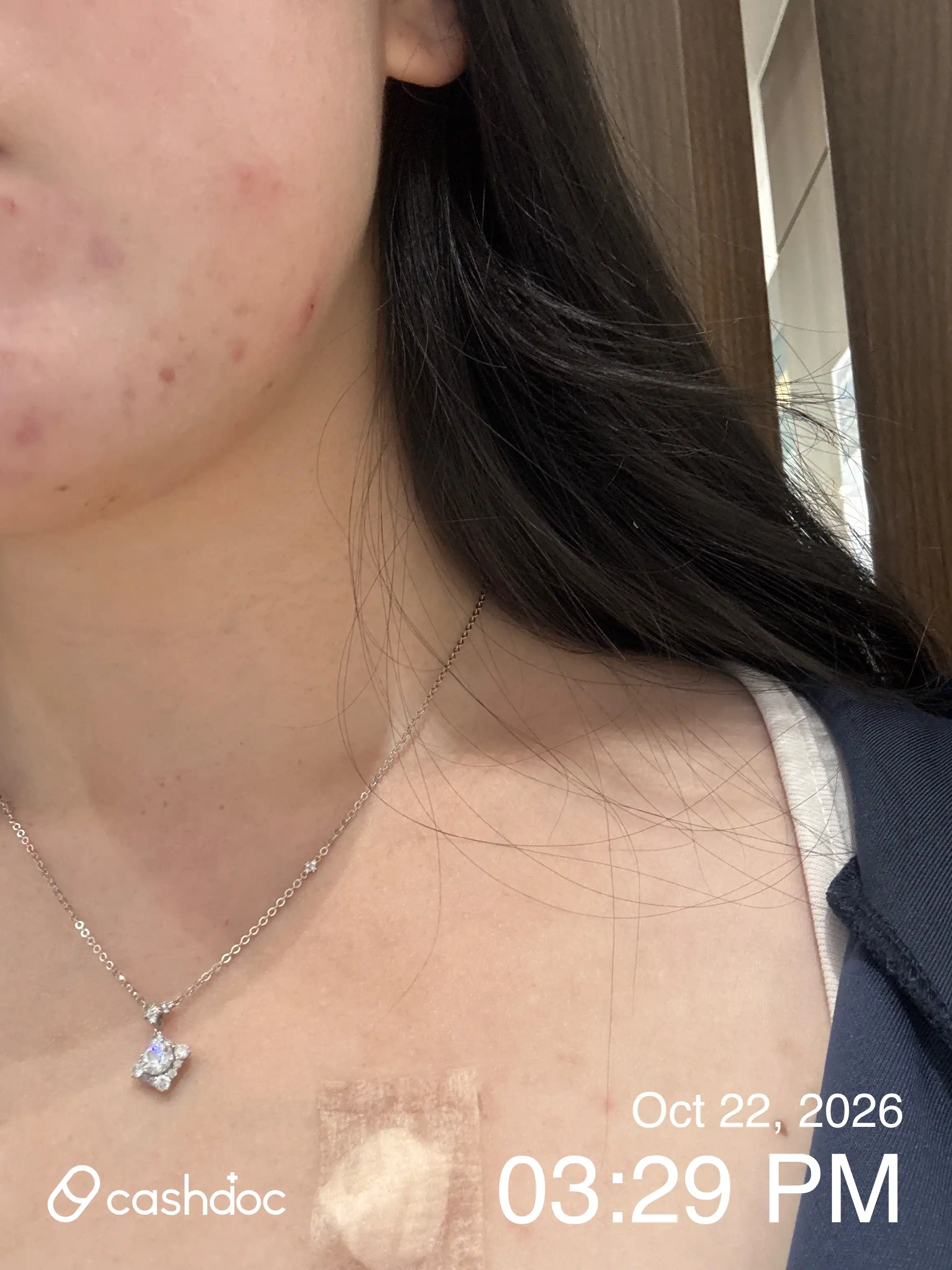 美璞诊所 东柏分院 评价照片