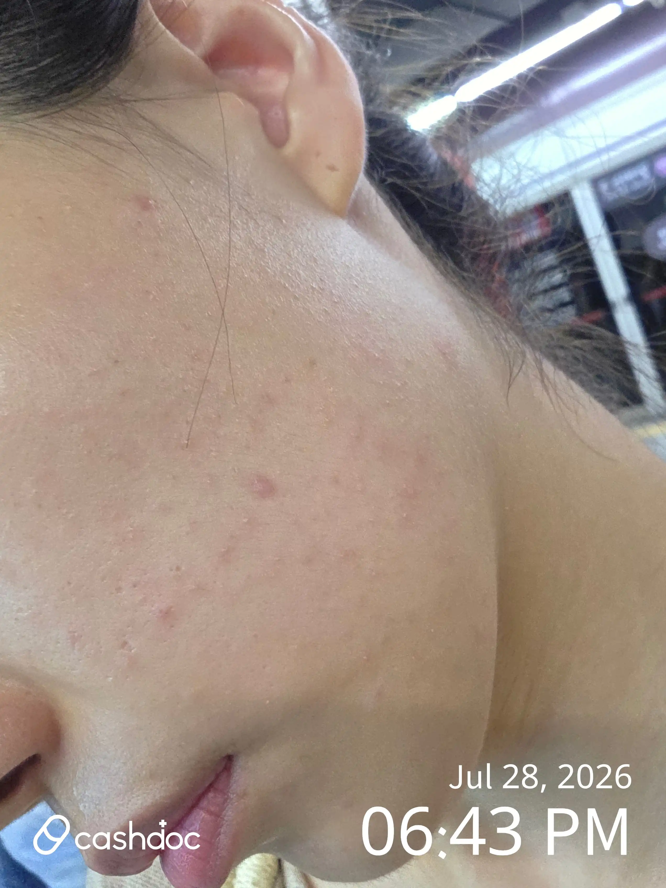评价照片