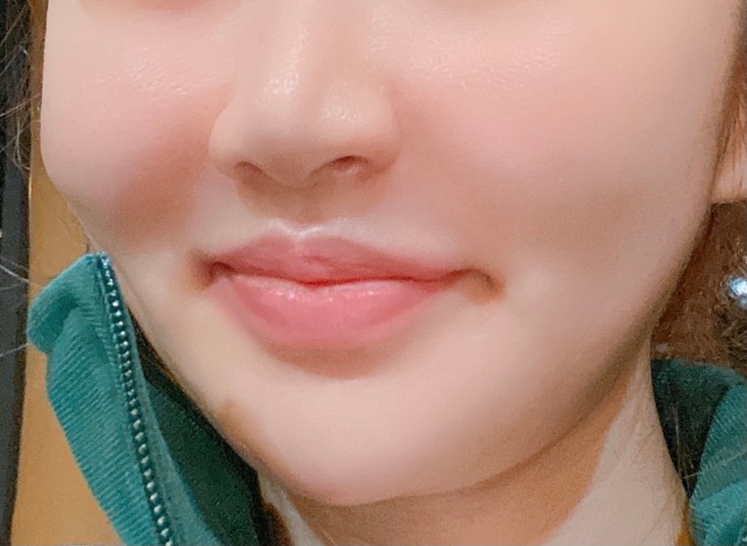 전