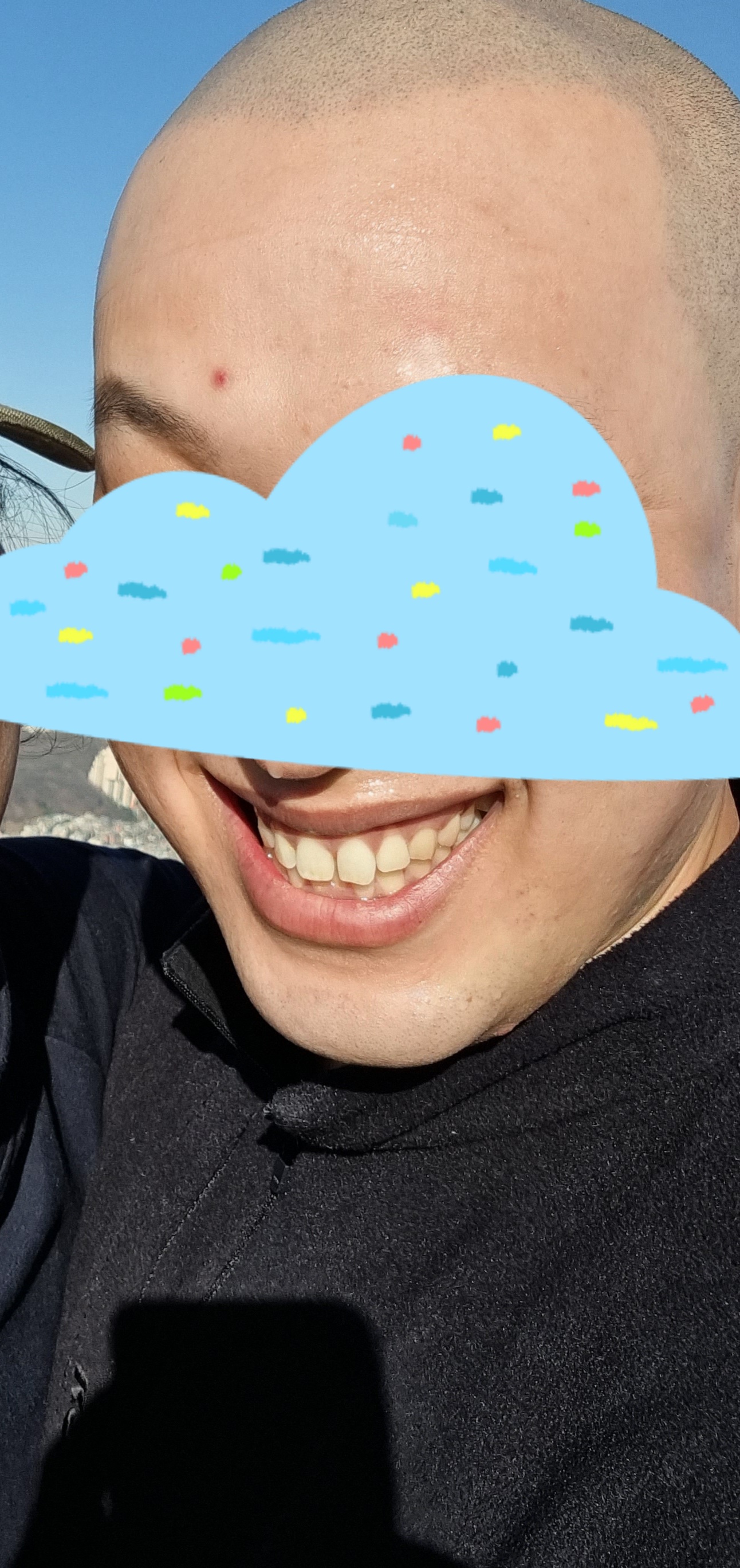 Before