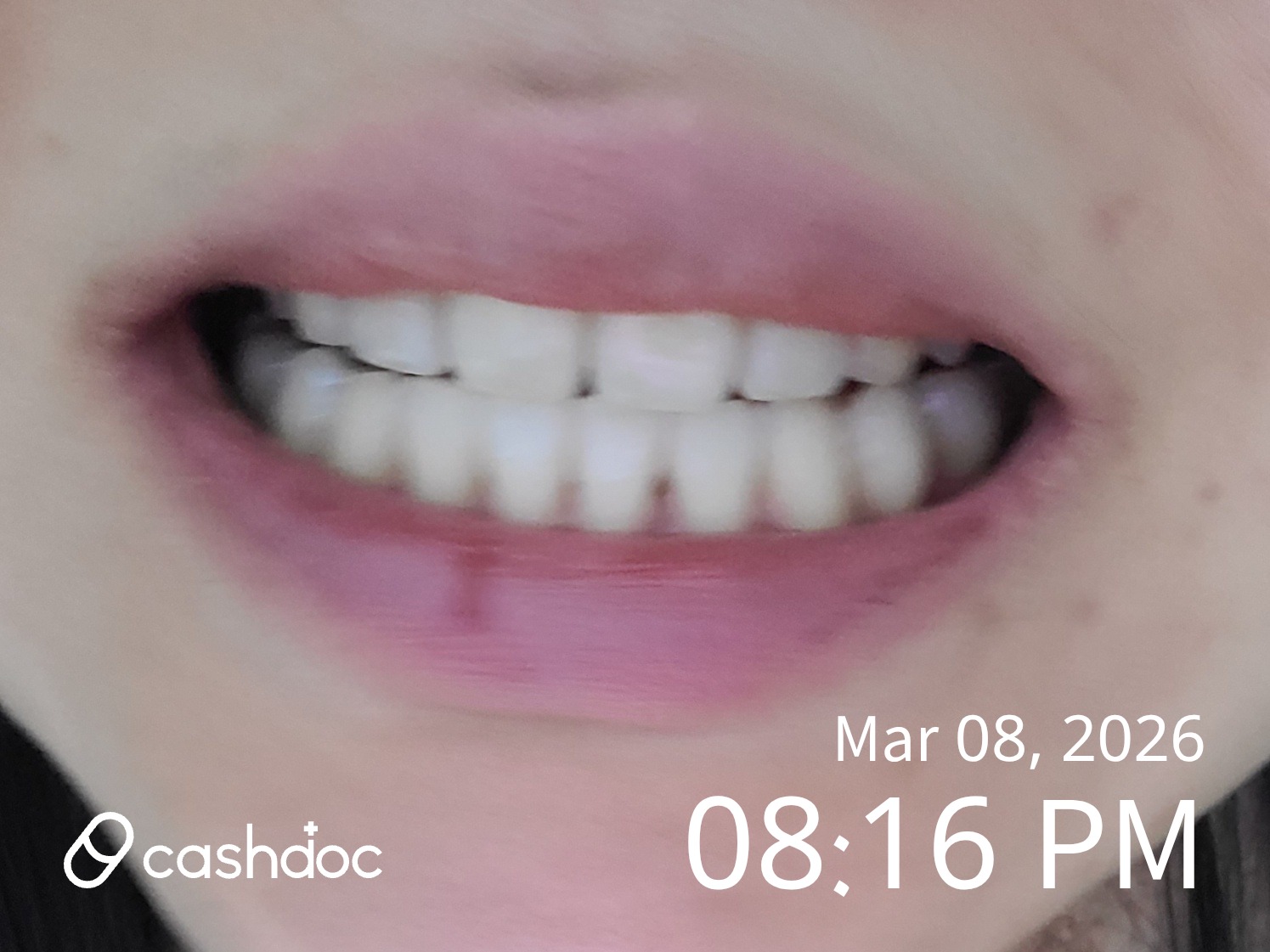 굿프렌즈치과의원 광진구, 치과 진료 만족스러워요