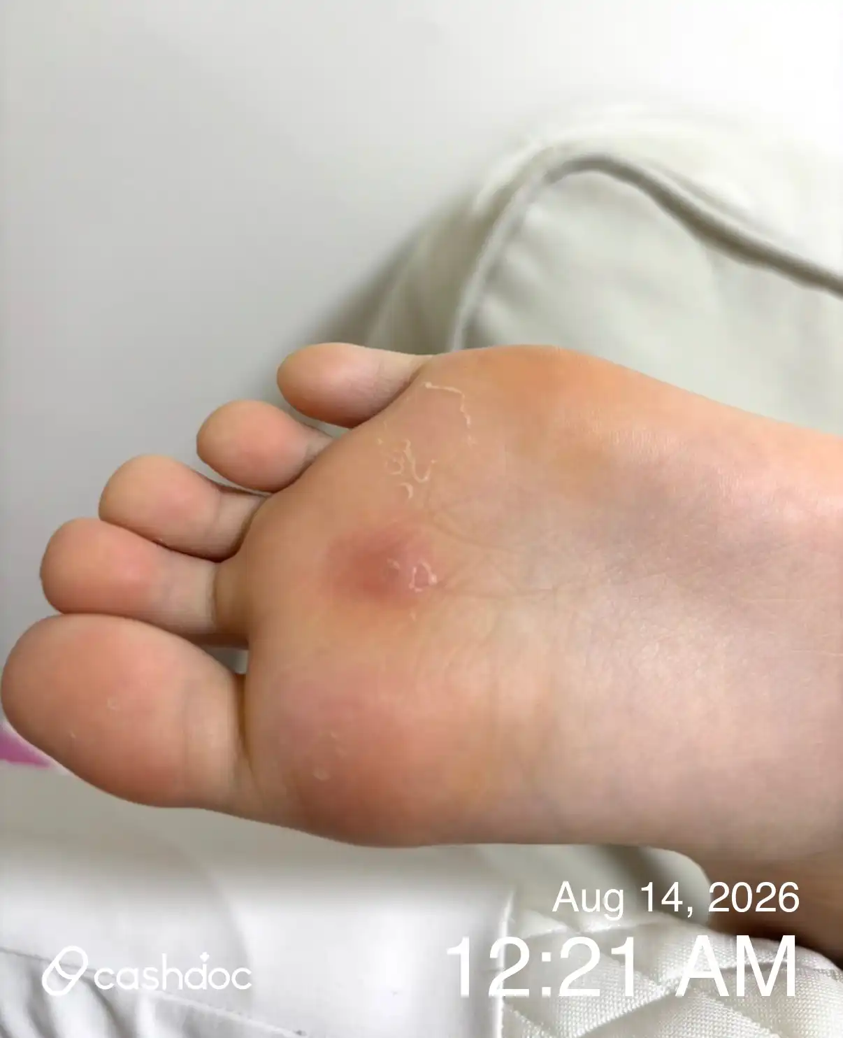 评价照片