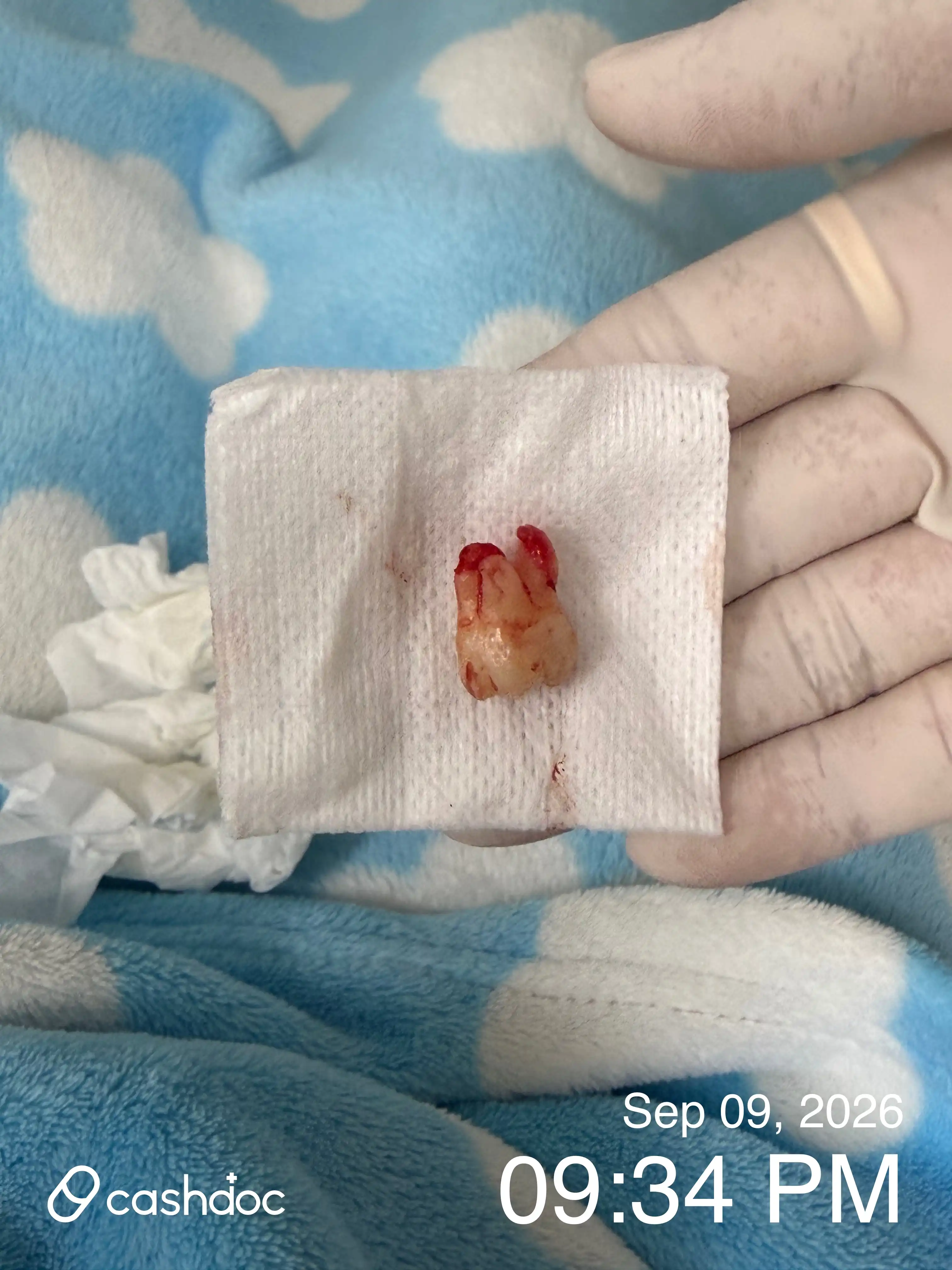 评价照片