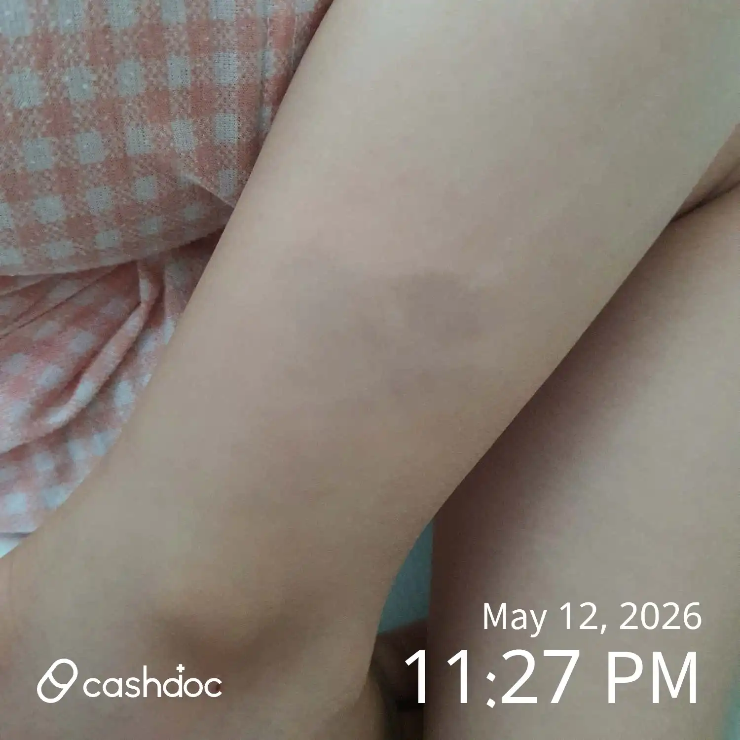 Review photo