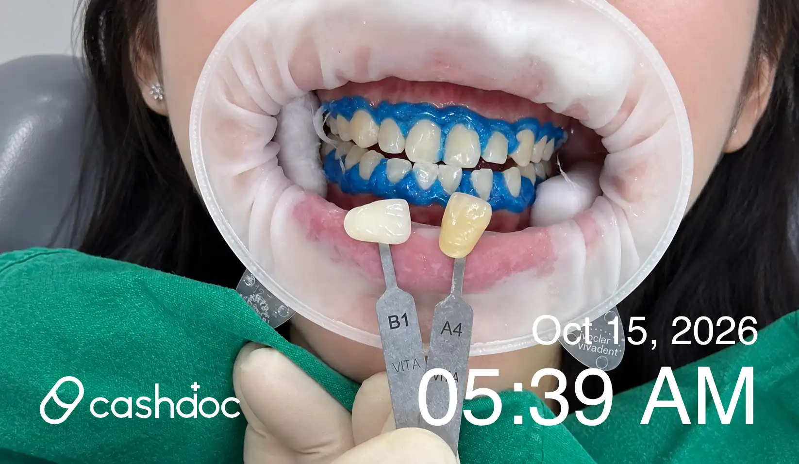 Review photo