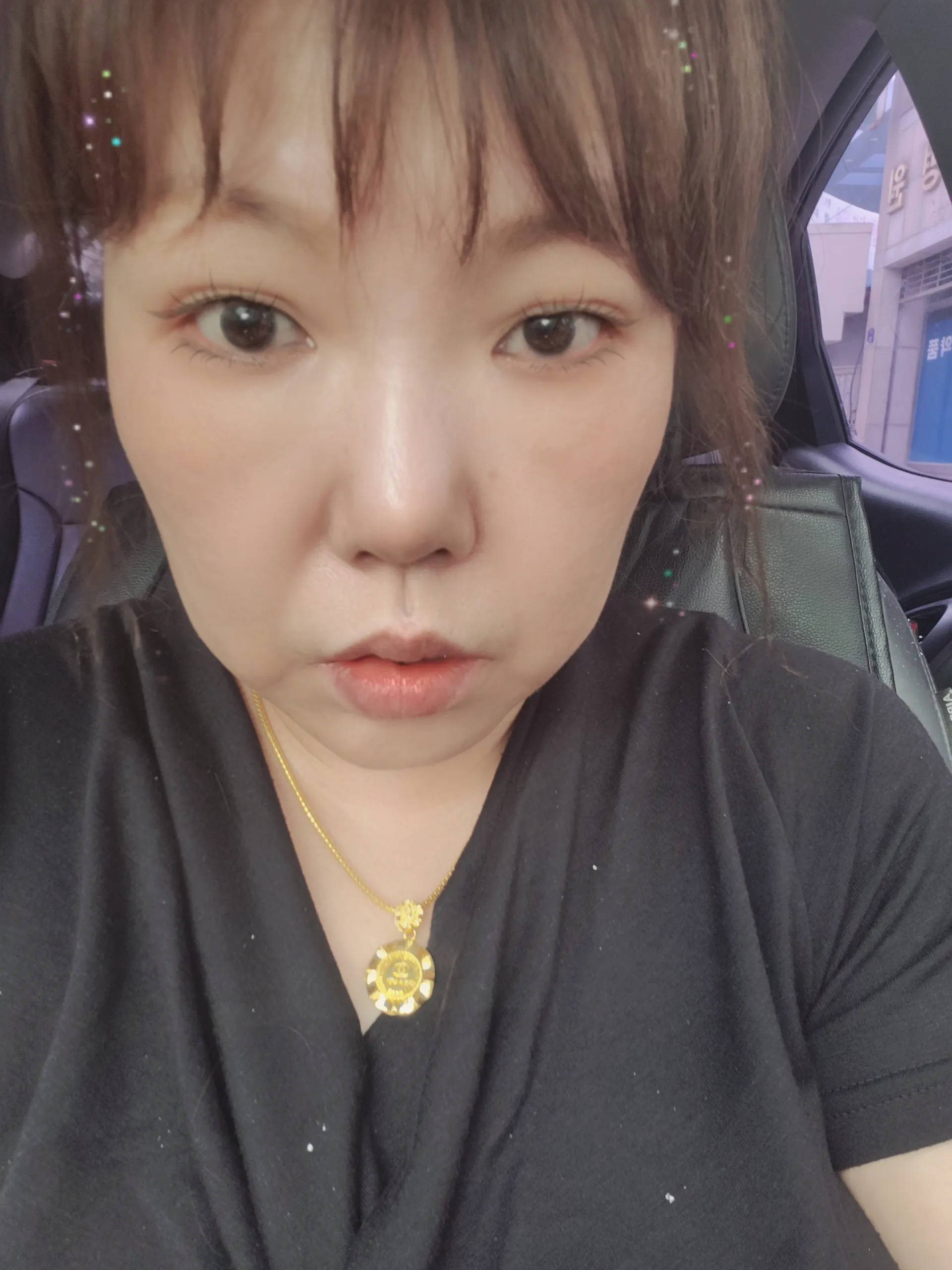 시술 전 — 드레스 단단듀얼트임