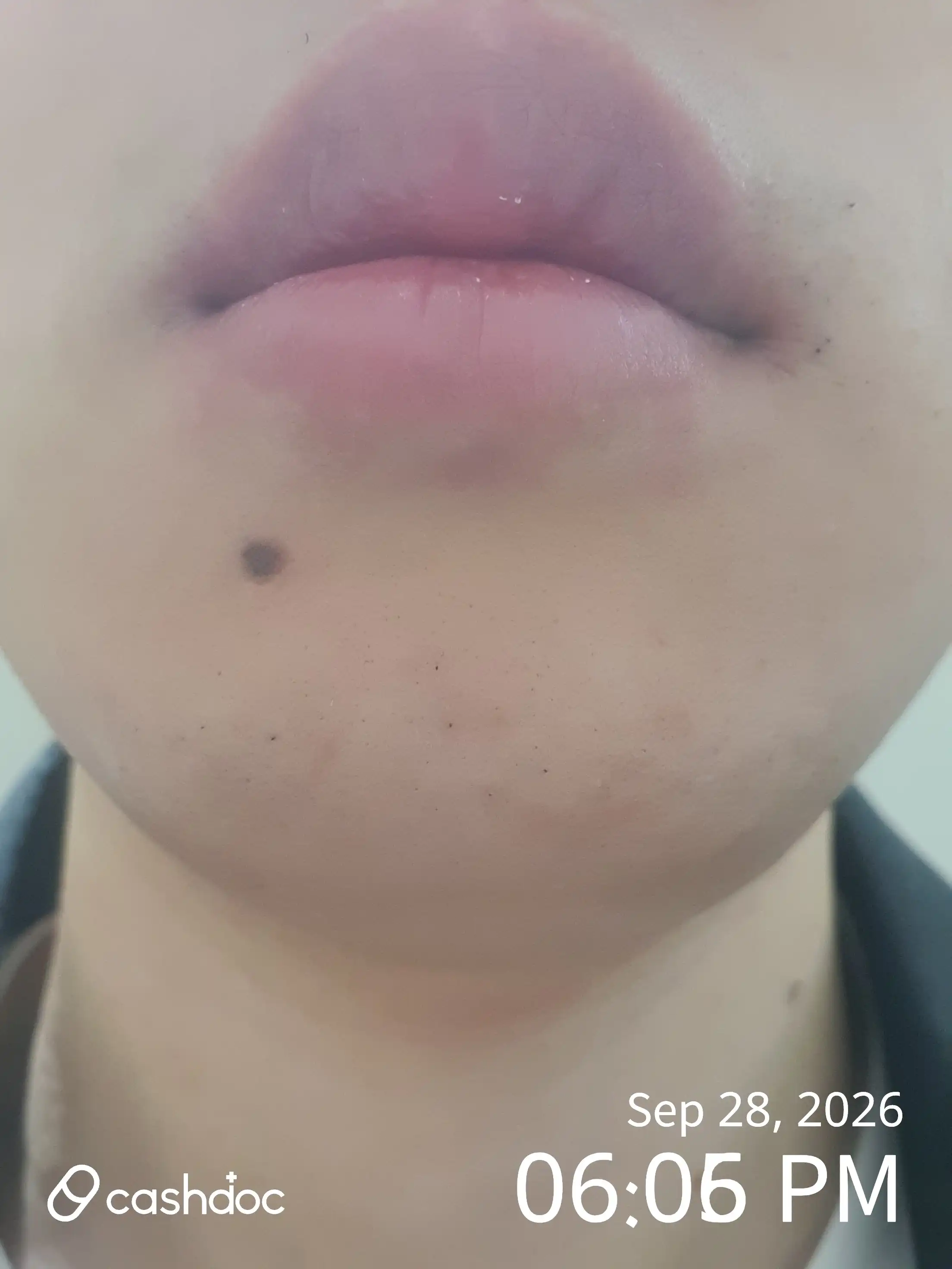 评价照片