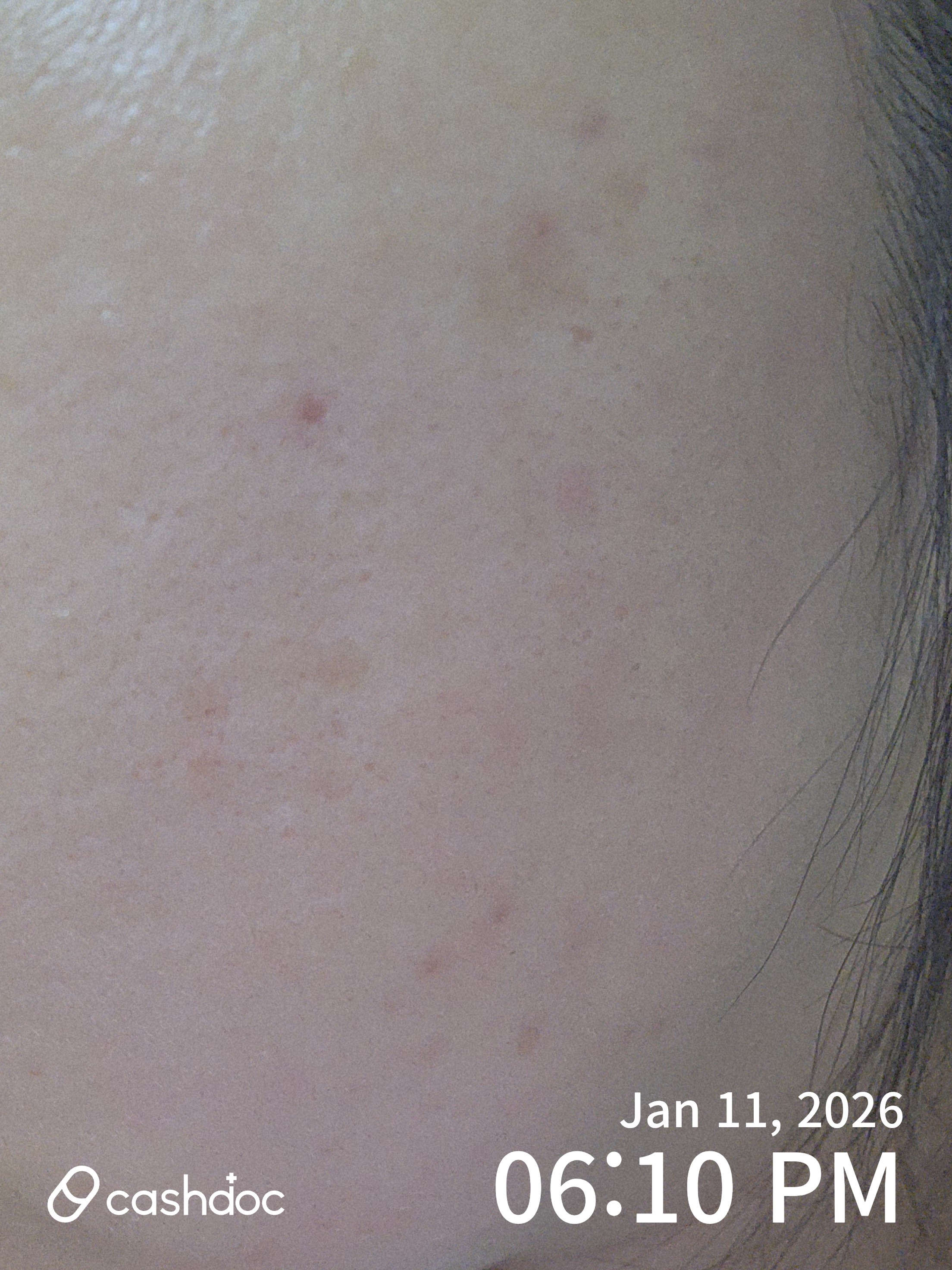 순천시 필앤톡의원, 리쥬란 시술 후 만족도 높아요