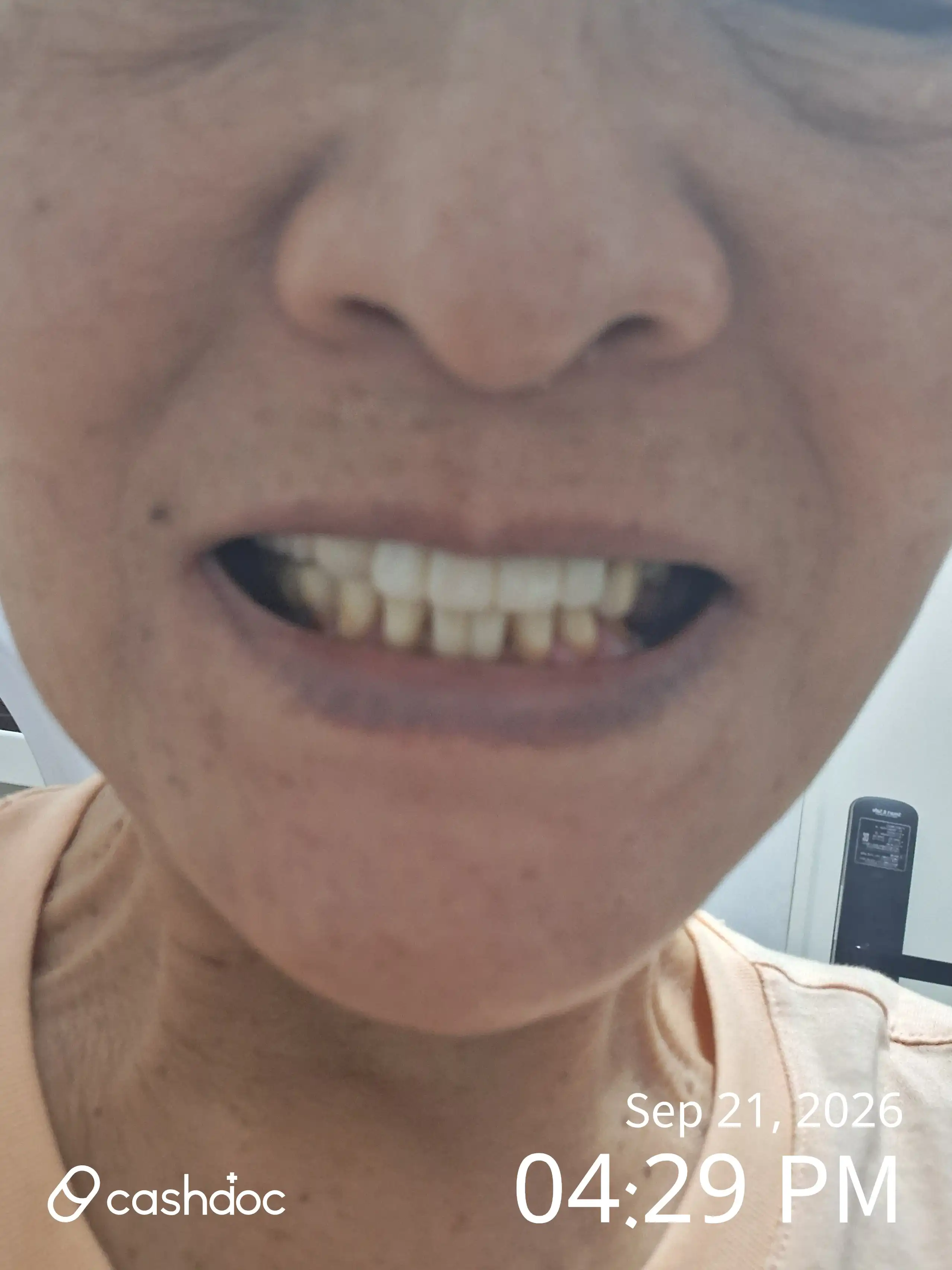 리뷰 사진