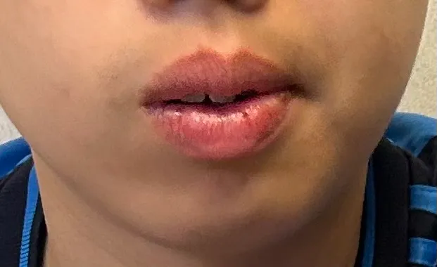 Review photo