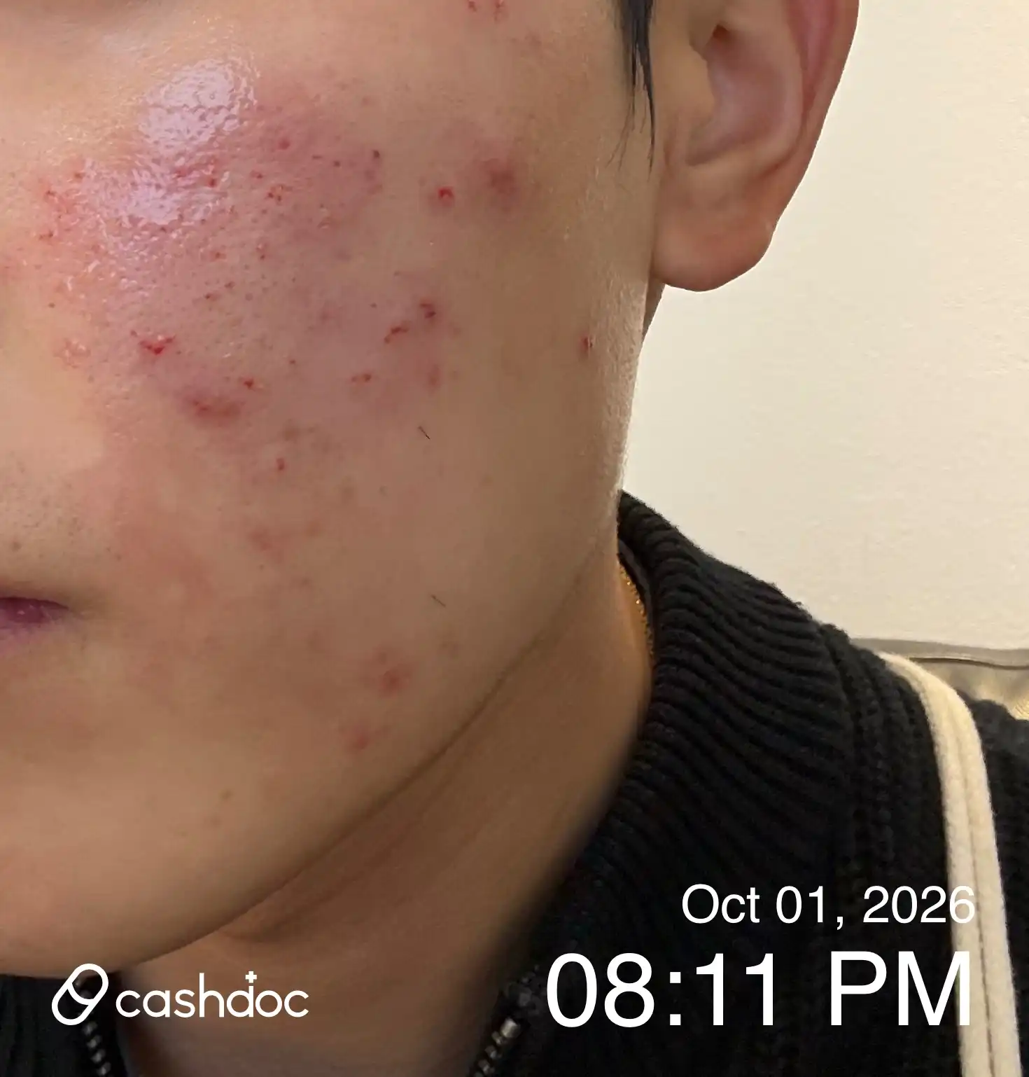 Review photo