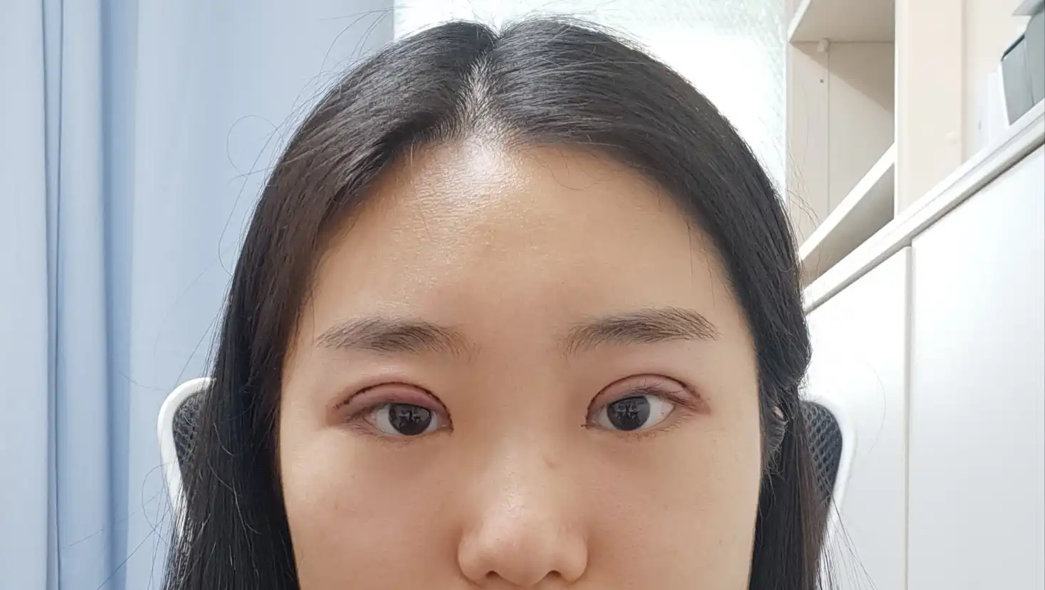 후