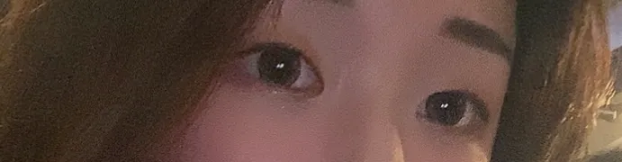 After treatment — Lize Eye (Rejuran Eye + Eye Shrink) Package
