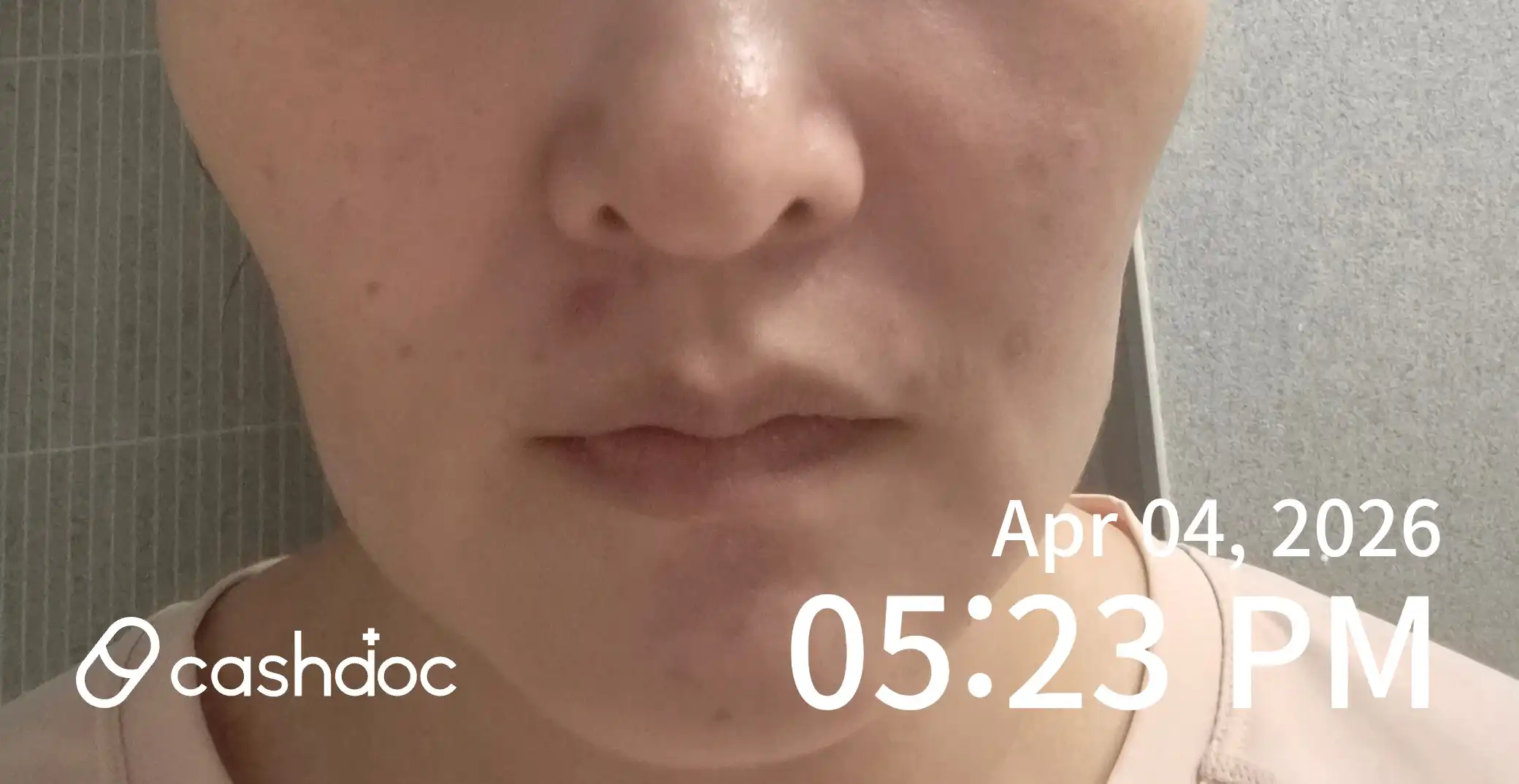 Review photo