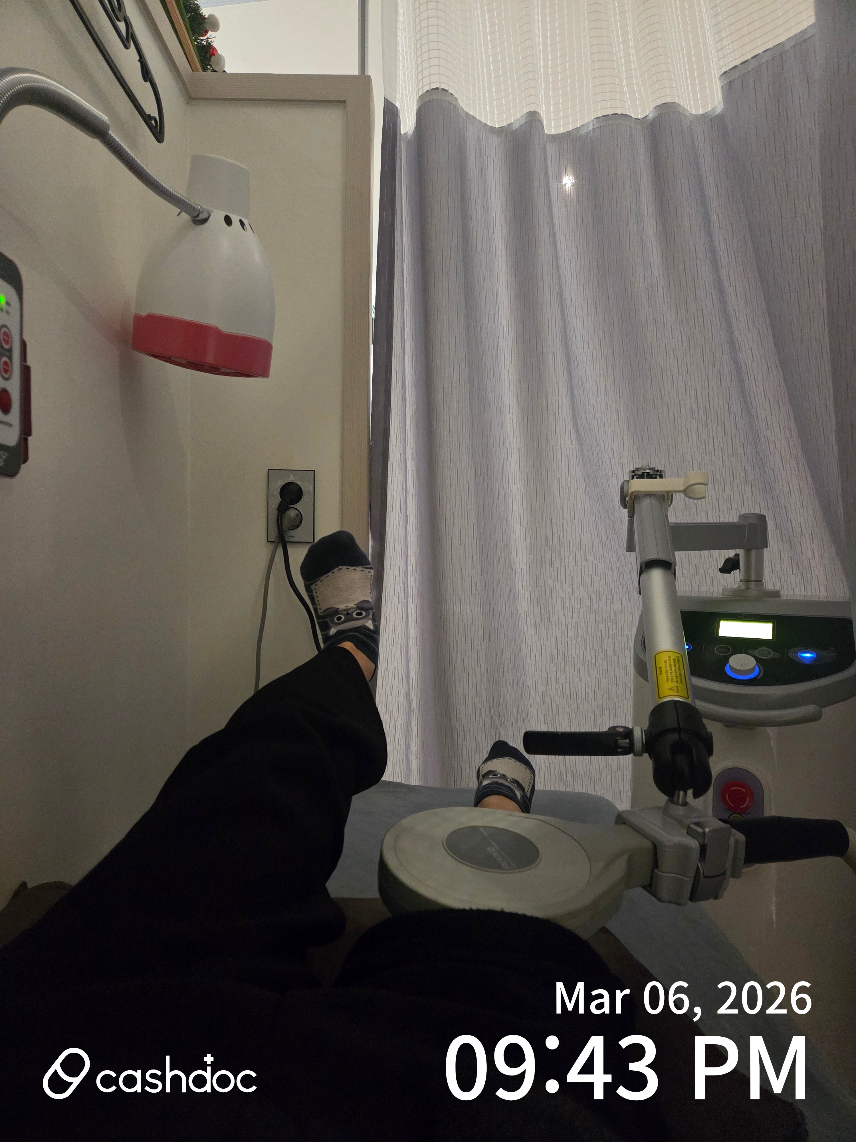 남양주시 별내정형외과의원에서 퇴행성관절염 충격파 치료 후기