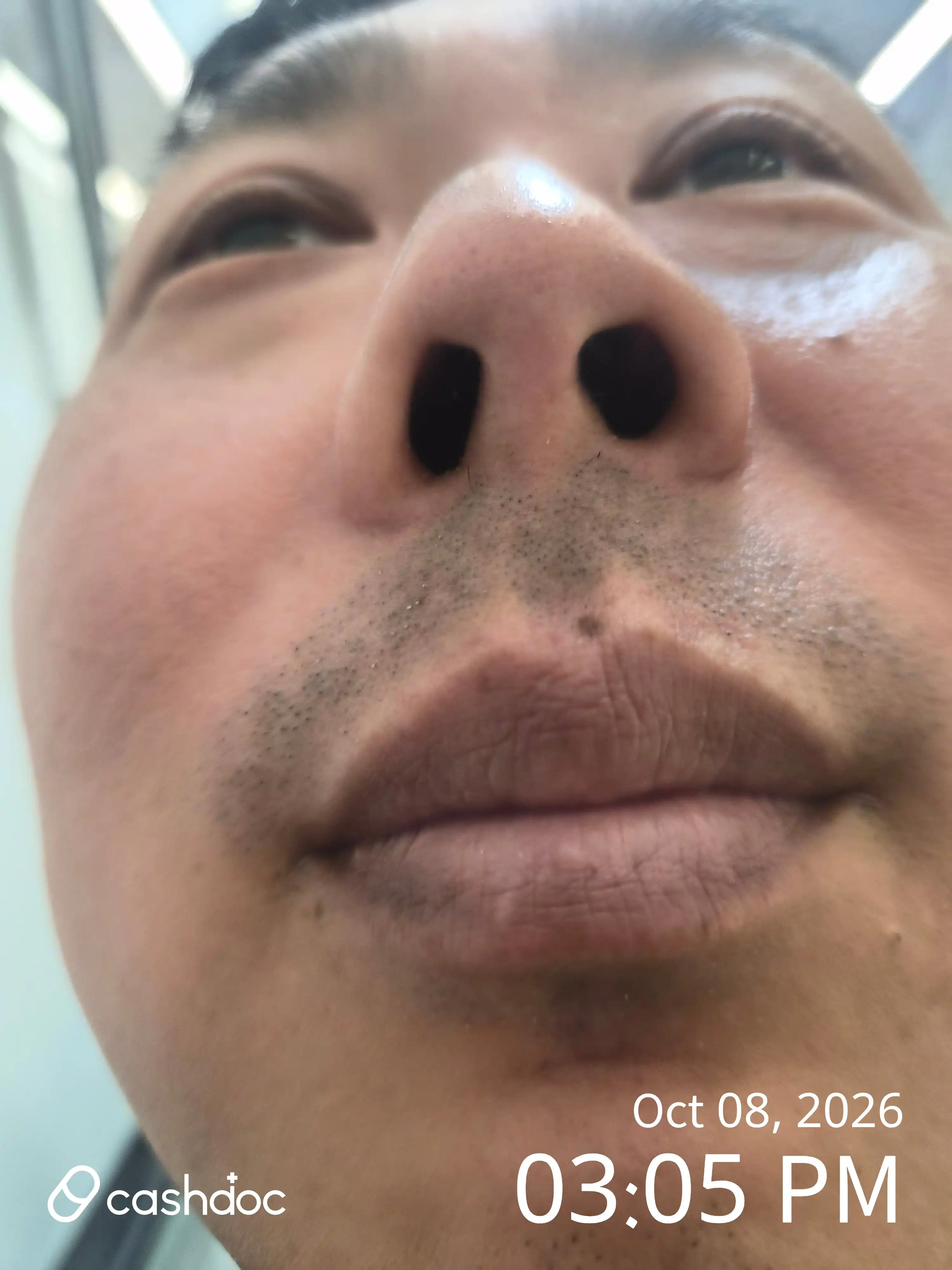 レビュー写真