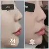 後