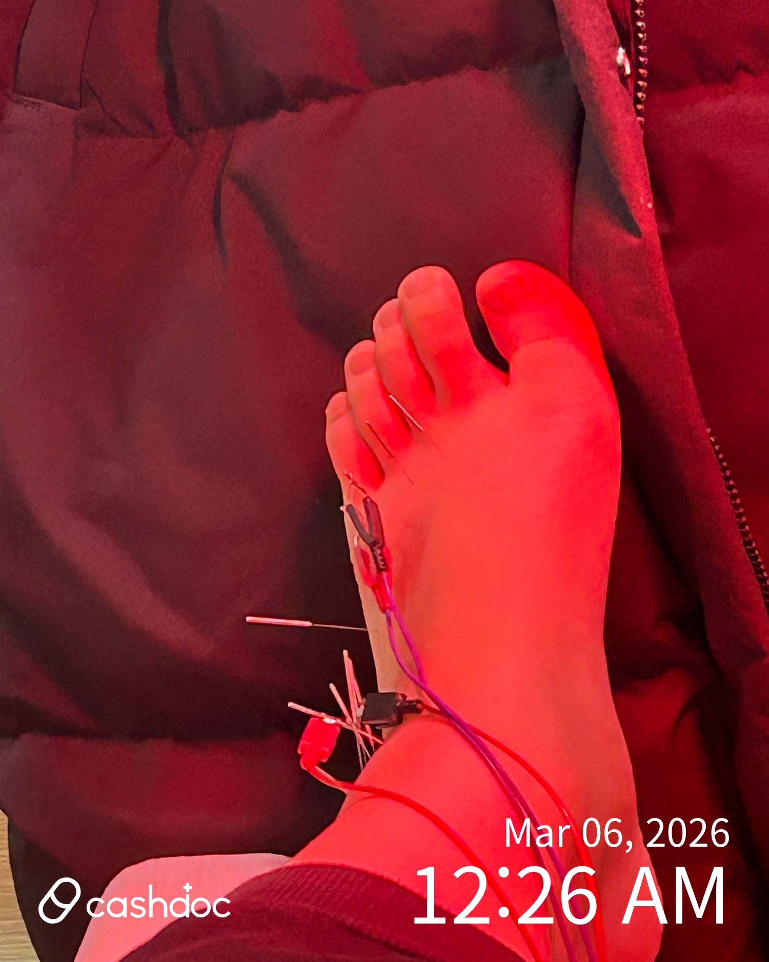 강릉시 심석인한의원, 다이어트 성공 후 염증 사라져