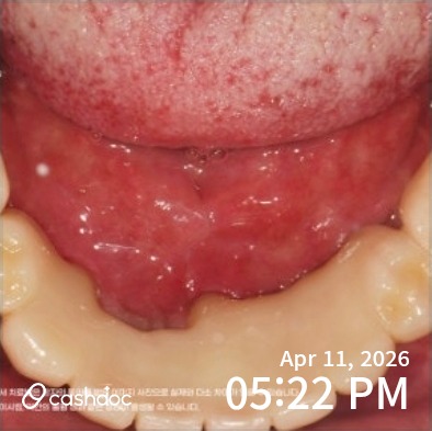 동래구 김유광치과의원, 친절해서 기분 전환 됐어요!