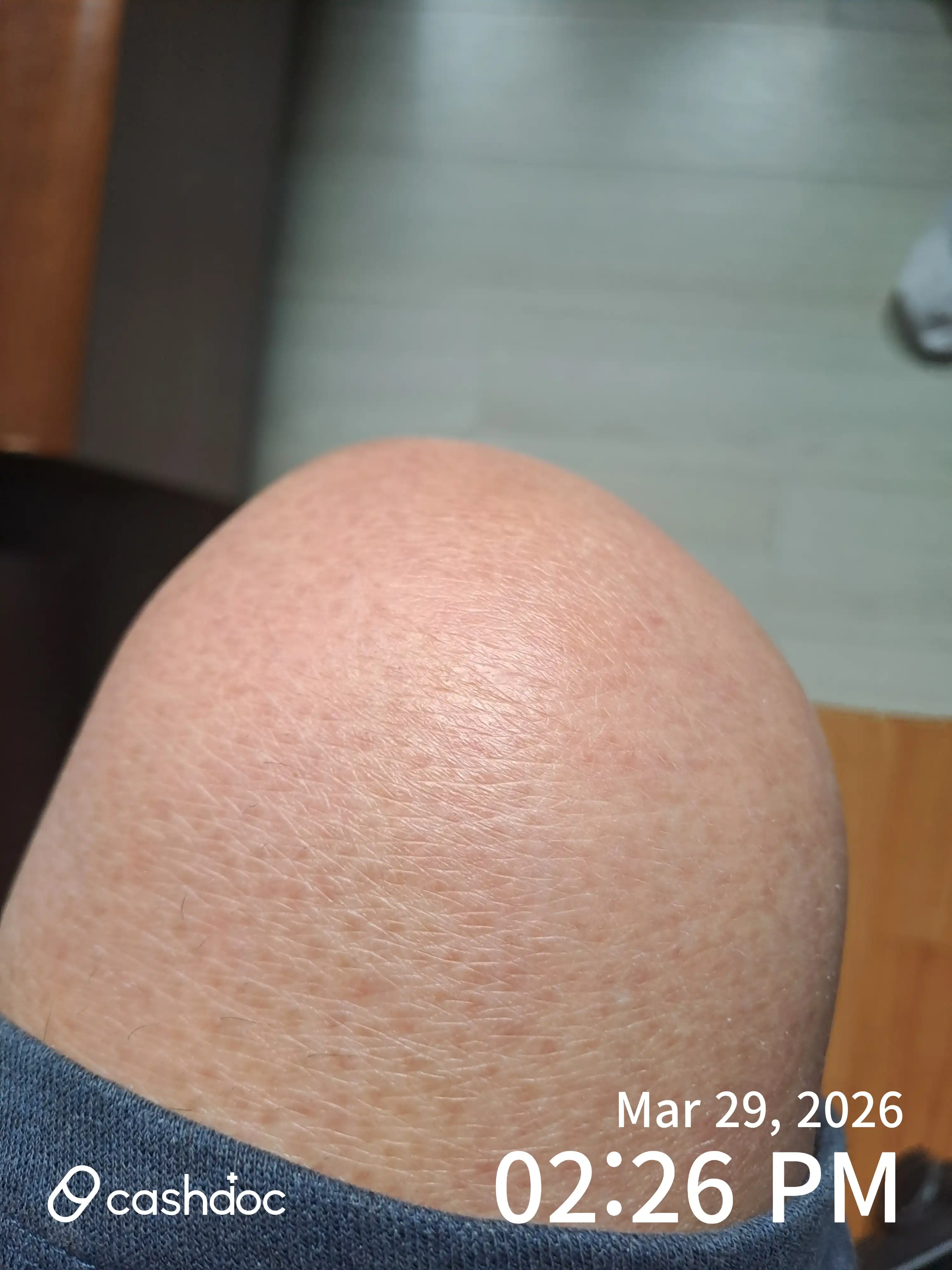 리뷰 사진