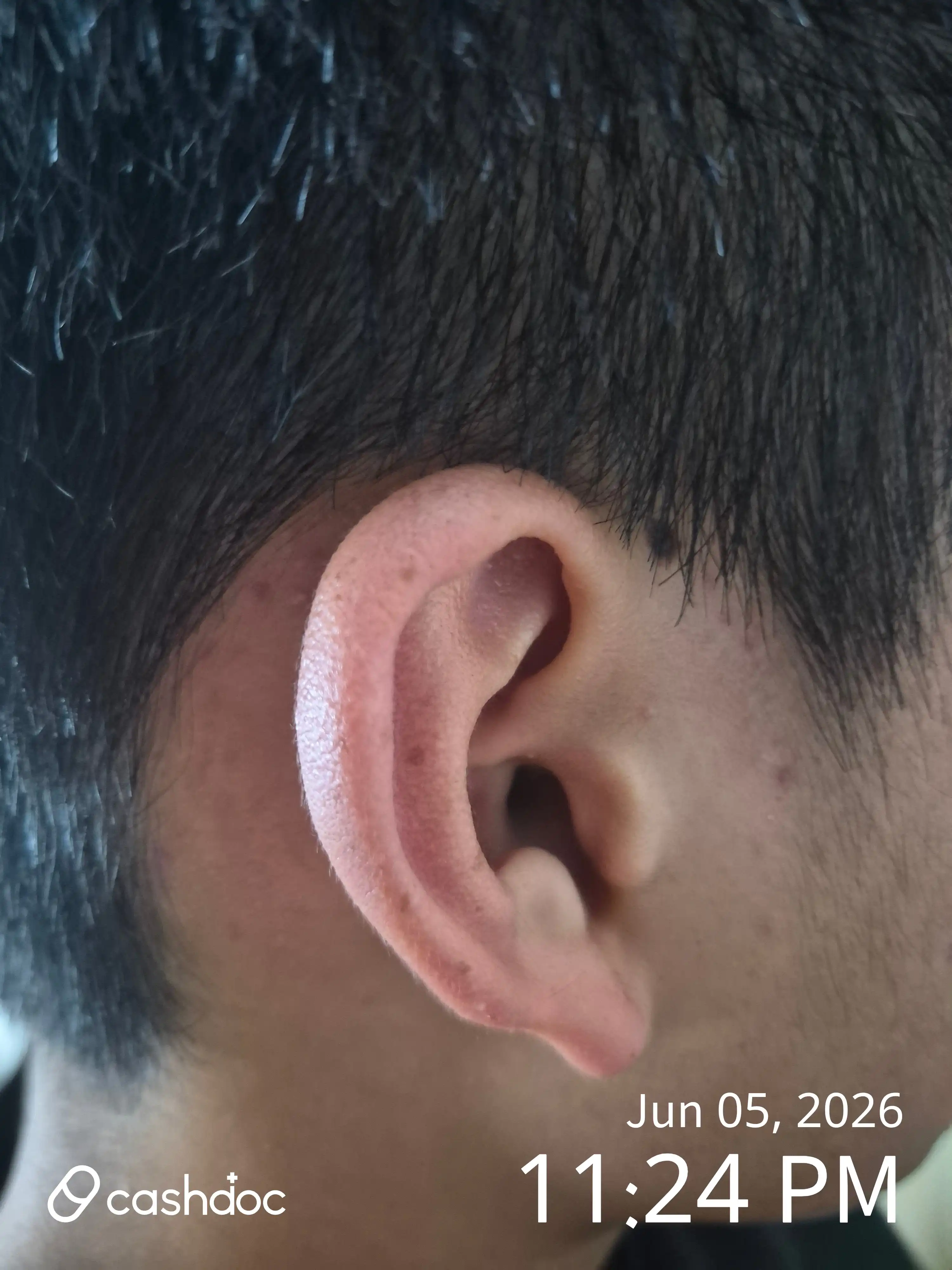 Review photo