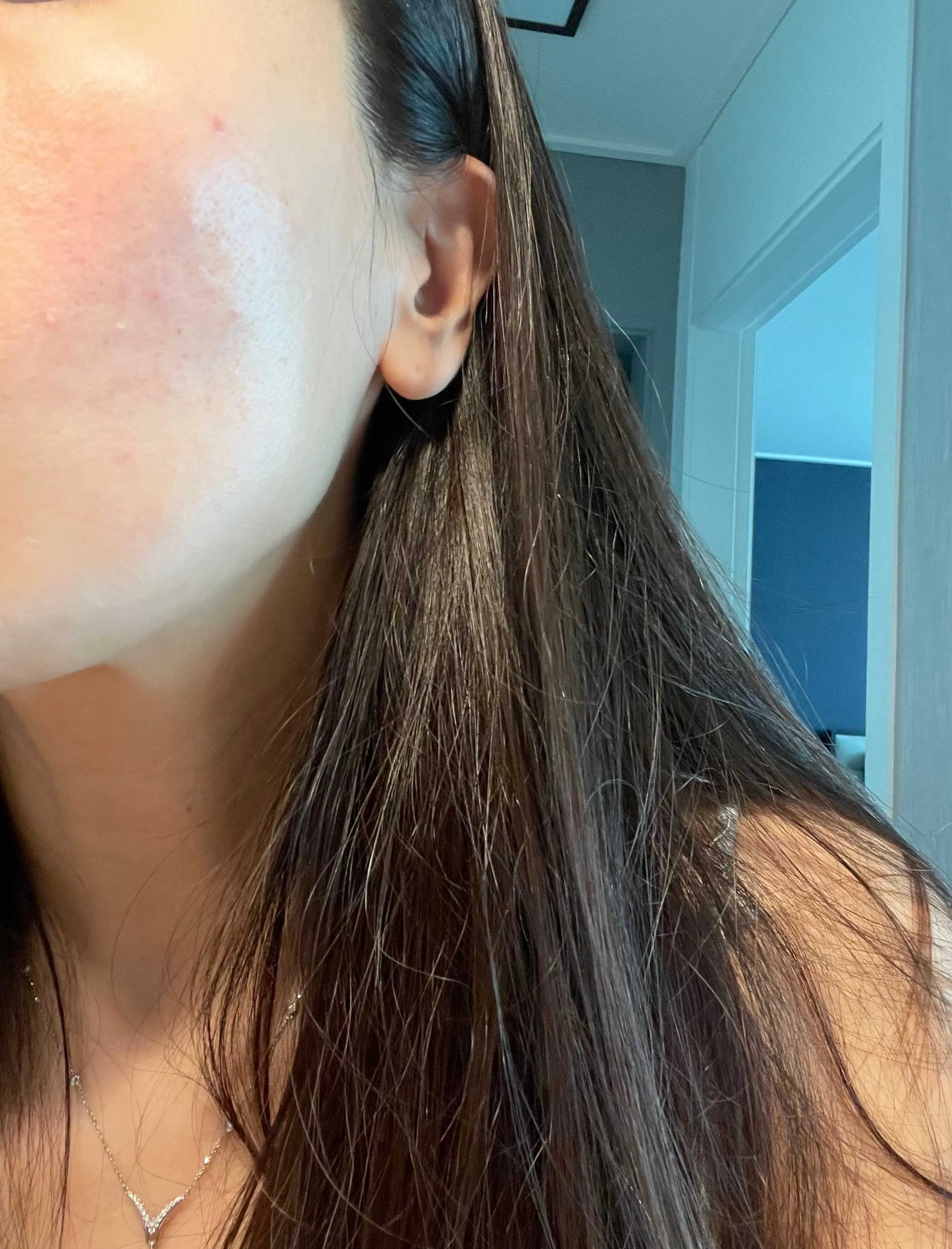 After treatment — Have skin concerns? Try RejuAide!